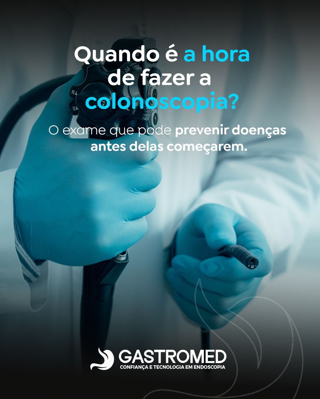 A colonoscopia é um exame essencial para o rastreamento e diagnóstico das doenças do intestino grosso — especialmente o câncer colorretal, que é um dos tipos mais comuns, porém altamente prevenível quando identificado precocemente.
O procedimento permite visualizar todo o cólon e o reto, além de remover pólipos e realizar biópsias no mesmo momento. Mesmo pessoas sem sintomas devem iniciar o rastreamento a partir dos 45 anos, ou antes quando há histórico familiar ou fatores de risco.
👉 Se você tem sintomas ou chegou na idade recomendada para rastreamento, converse com a equipe da Gastromed e agende sua avaliação. A prevenção ainda é o melhor caminho.