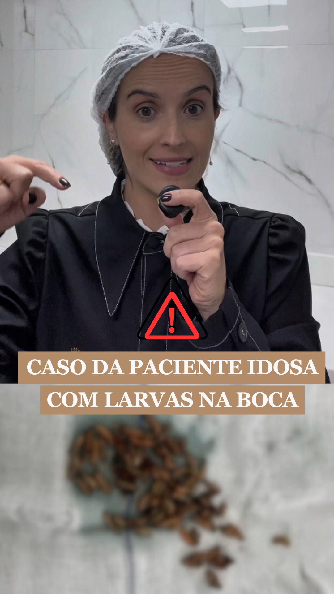 Cuidar da saúde bucal de idosos debilitados não é estética.
É dignidade. É prevenção. É respeito.
Uma paciente idosa, com Alzheimer avançado, chegou até mim com miíase oral, uma condição rara, mas que pode acontecer quando a higiene é esquecida ou quando o paciente não consegue mais se cuidar sozinho.
O caso foi tratado e ela se recuperou bem, mas serve de alerta importante.
Em muitos casos, quem cuida não sabe que a escovação precisa continuar mesmo quando o idoso passa a se alimentar por sonda.
E é aí que pequenos descuidos viram grandes complicações.
👉 O que todo cuidador precisa saber:
🦷 A higiene bucal NUNCA deve ser interrompida.
🦷 Escova macia, gaze umedecida ou produtos específicos podem ser usados conforme orientação profissional.
🦷 A boca precisa ser avaliada regularmente, mesmo quando o paciente não relata dor.
🦷 Prevenção é sempre o caminho mais seguro.
Cuidar da boca é cuidar da saúde inteira e do bem-estar de quem já não consegue expressar sozinho o que sente.
Se você cuida de um idoso, acamado ou alguém com Alzheimer, não espere um problema aparecer.
Procure um dentista e peça orientações personalizadas.
📍 Em Belo Horizonte, estou aqui para ajudar.
👉 Agende uma avaliação pelo link da bio.
#tratamentodedente #dentistabh #dentistacirurgiabh #saudebucal #bucomaxilobh