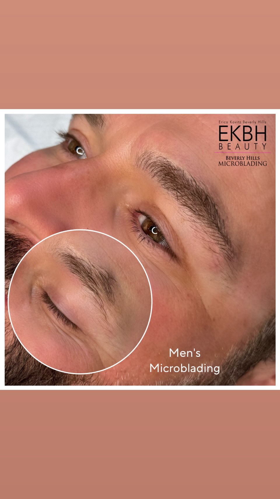 Men’s microblading is one of my favorite procedures.
I love having this as a specialty.
No two are ever alike.
Every brow is custom and designed to fit the face naturally.
Clean, subtle, undetectable results.
To book
Text 310 853 0744