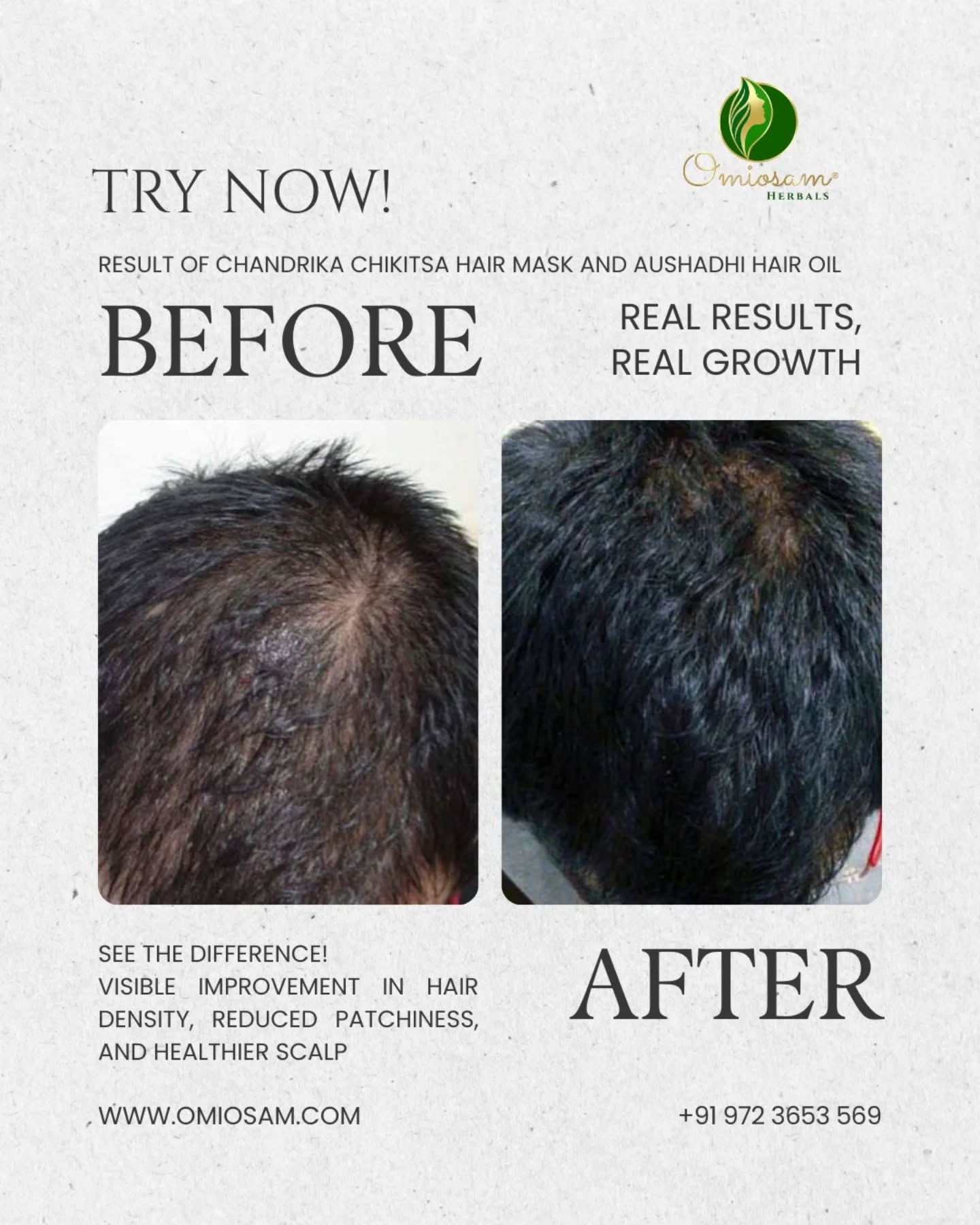 Rooted in Ayurveda. Trusted by families. Omiosam Hair Care Combo supports long-term hair health naturally.
Shop Now
www.omiosam.com
+91 9723653569
