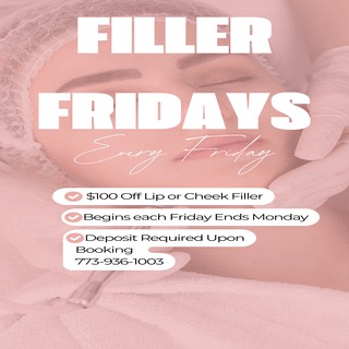 FILLER FRIDAY! We are extending our sale Saturday to Tuesday.
Book now for $100 lip or Cheek Filler.
#lipfiller #filler #cheekfillers
