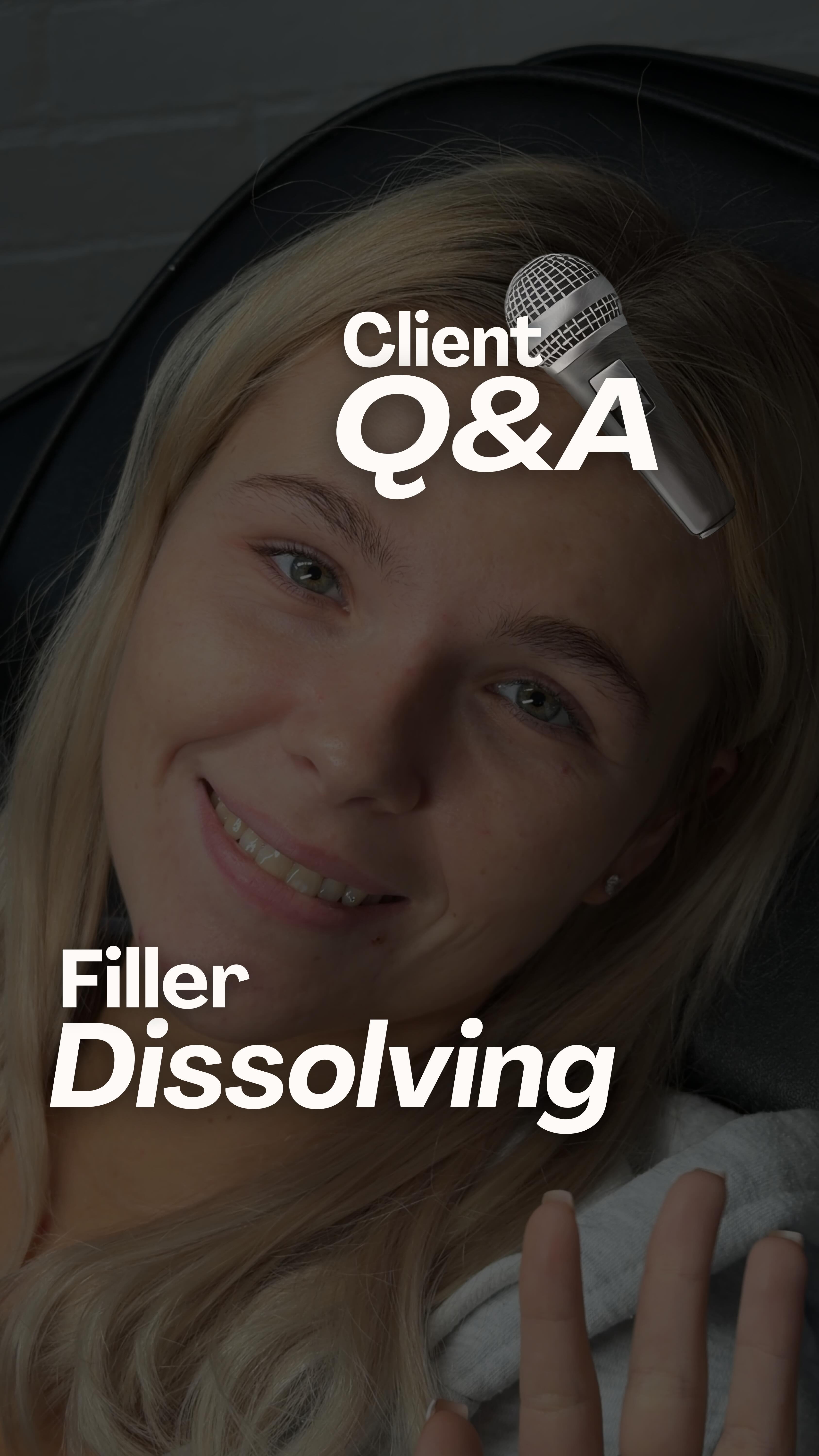 A real + honest chat with my gorgeous client Abi, about her dissolving journey and why sometimes pressing reset is the best thing you can do 🤍
After years of topping up, she’d become blind to the amount of filler sitting in her lips and as migration crept in around her lips, plus superficial lumps in the wet dry border, her results had stopped looking fresh. After several talks on why I thought it was best to dissolve, She finally took the leap to and start fresh ✨
Why did we wait 2.5 months before refilling?
Because once filler migrates or creates small lumps inside the lip, those areas need time to close after dissolving.
If you refill too soon, the new filler will simply fall back into those same pockets. This could be the reason why you find the lumps or migration return in the exact same places if you have dissolved and refilled in the past.
By giving her lips enough time to heal, we have been able to create a healthy base for a beautiful, natural result again - exactly what she wanted 🤍
If you’re considering dissolving or feel your lips aren’t looking the way they used to, you’re not alone. Starting fresh might be the best decision you make ✅
Free Consultations Available
Link in Bio or DM to Book 🖤
#lipdissolving #lipfillercorrection #Lipmigration #fillermigration #fillerdissolving #naturalenhancements #naturalresults #lipfillerswestsussex #lipfillers #aestheticsburgesshill #aesthetics