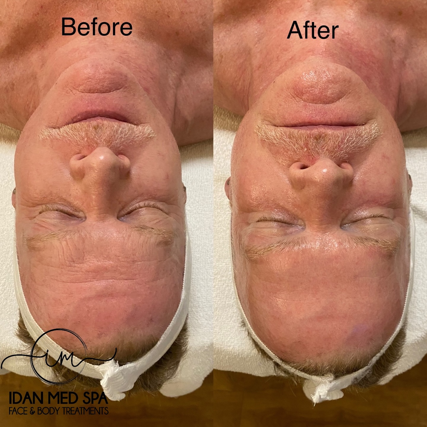 Triple Layer Facial Triple the Glow
Three powerful layers. One flawless result.
Deep cleanse, intense hydration, and skin renewal all in one treatment.#
Glowing, smooth, and refreshed skin after just one session.
Book your glow-up today 💆♀️✨
#TripleLayerFacial #BeforeAndAfter #GlowSkin #SkinTransformation FacialTreatment HydratedSkin GlowingSkin