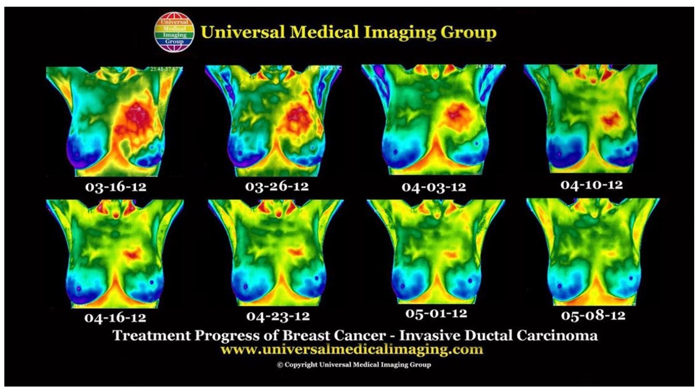 **FREE Thermography Class (ZOOM) @ Ascension Naturopathic Healing Center**
Thursday, October 29th @ 6:30 PM EST!!
RSVP: Email office.drkat@gmail.com