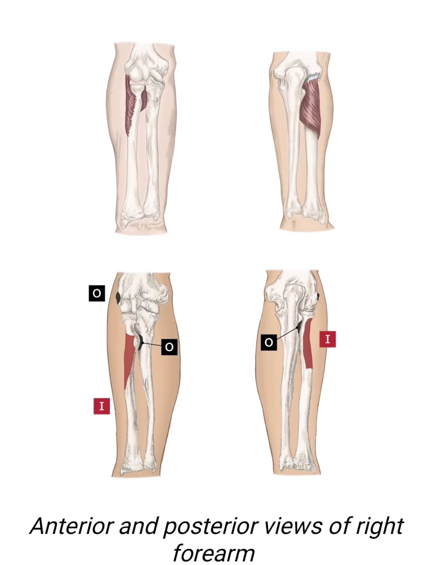 Late to the Muscle Monday game so today is Tone Tuesday 💪
The supinator is a small but mighty muscle in the upper forearm that often goes unnoticed — yet it plays an essential role in how we move every day. Located near the elbow, it wraps around the radius bone and helps us turn our palm upward, a motion called supination. Think of it as the muscle that lets you hold a bowl of soup — hence its easy-to-remember nickname, the “soup-inator.” While the supinator quietly assists your biceps in rotating the forearm, it tends to be underused compared to its opposite group, the pronators, which turn the palm downward.
Everyday tasks like typing, driving, and using tools naturally favor pronation, leaving the supinator a bit sleepy and less active. When this balance tips, it can lead to outer forearm tightness or fatigue during repetitive activities. A little mindful movement can help — try gently rotating your palm up and down or adding light resistance to wake the muscle back up.
Here’s a fun fact: the supinator keeps working even when your arm is straight, while the biceps can only help turn your palm when your elbow is bent. So the next time you open a jar, twist a yoga strap, or pour your morning coffee, take a moment to appreciate this spiral of strength that keeps life — and your movement — turning smoothly.
Be well,
Zoey Fern
Image: Trail Guide to the Body
