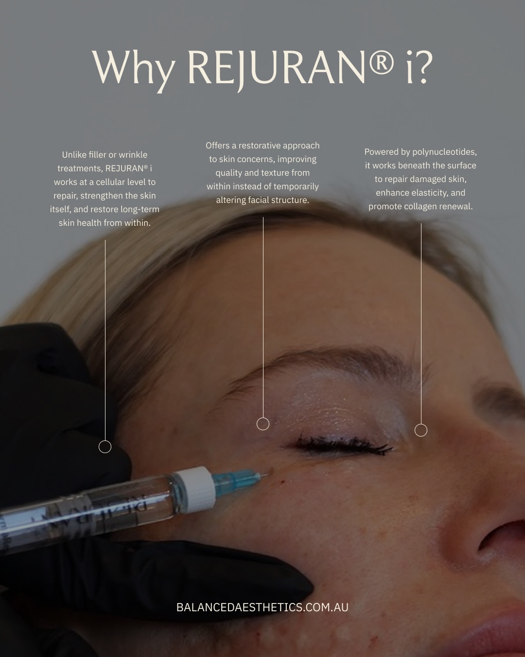 Introducing a limited time REJURAN® i 2-for-1 treatment offer.
REJURAN® i is designed to work beneath the surface to restore and rejuvenate your under-eye skin.
Bookings are limited, please call or text us on 0458 166 971 to secure yours today 🤍