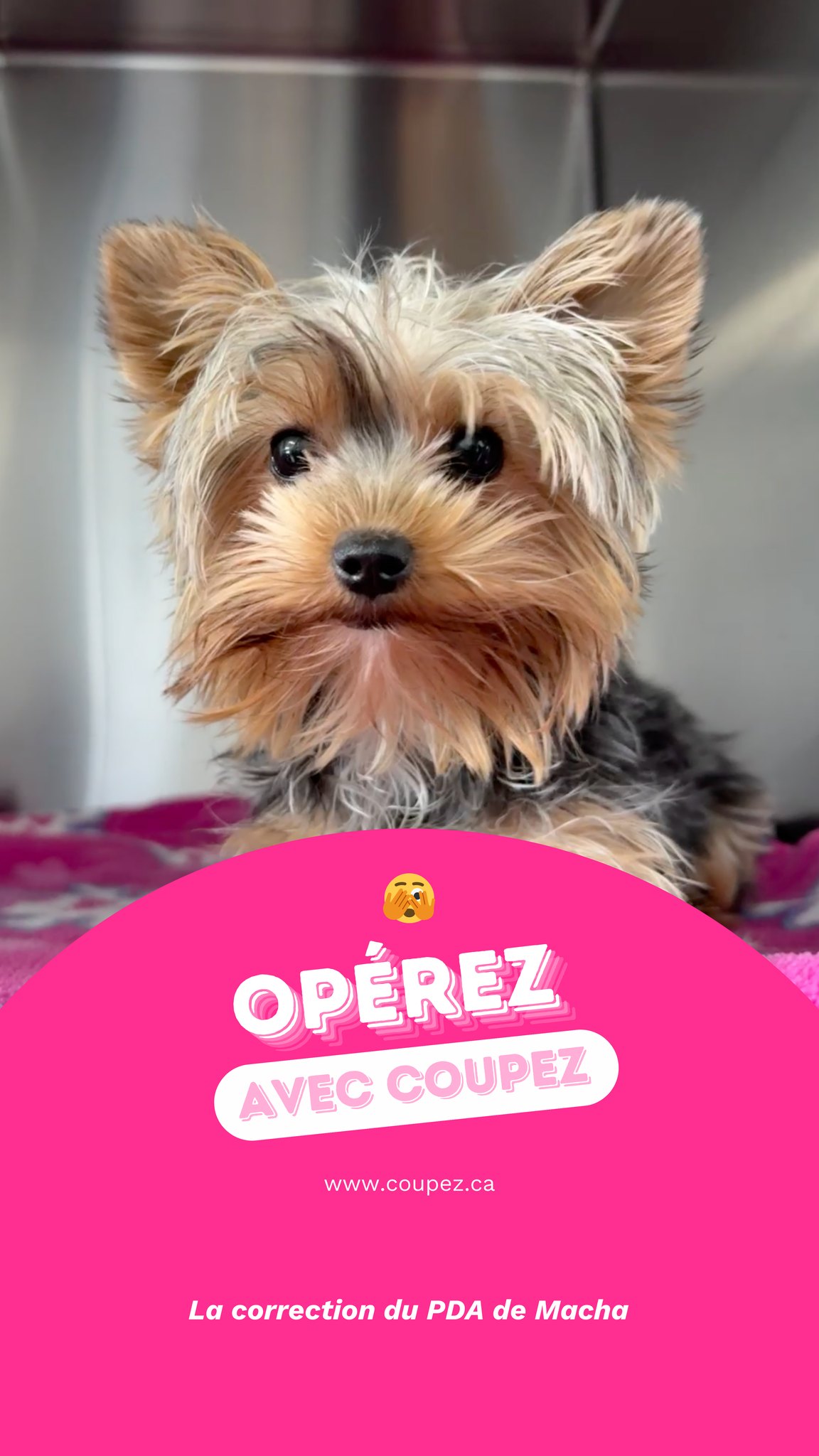 Une grande première pour Coupez: nous avons réalisé une chirurgie correctrice du PDA (persistance du ductus arteriosus ou canal artériel) sur Macha, une petite Yorkshire Terrier de seulement 9 mois.
Macha a été diagnostiquée avec cette anomalie cardiaque congénitale, qui laisse circuler le sang dans un passage anormal qui aurait dû se fermer à la naissance. Sans correction, cela peut entraîner une surcharge du cœur et écourter sérieusement la vie du patient. La Clinique vétérinaire Johannaise ( @cliniquevetjohannaise ) nous a donc contactés afin que nous puissions aider Macha. ❤️🩹
La chirurgie consiste à ligaturer ce canal anormal par une thoracotomie, soit accèder au cœur par une petite ouverture entre les côtes afin de fermer définitivement ce passage.
Nous remercions énormément le propriétaire de Macha pour sa confiance envers notre équipe pour cette chirurgie délicate, qui s’est très bien déroulée.
PS: la sœur de Macha, Maya, avait la même anomalie. Nous l’avons aussi opérée quelques semaines plus tard… restez à l’affût pour ne pas manquer sa chirurgie à elle aussi! ✂️