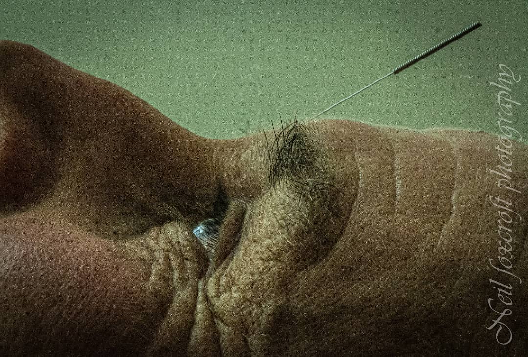 Acupuncture in waipukurau.
A common comment from patients is that asides from pain relief, they feel less stressed, sleep better and calmer in general.