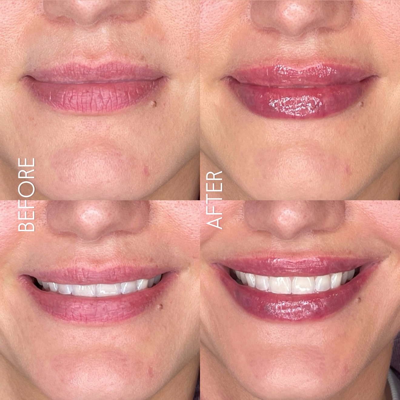 Juicy 👄 by @jess_sknmedicalspa