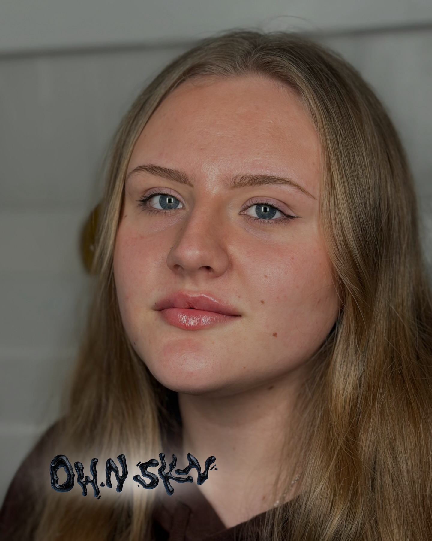I’ve had the pleasure of treating this gorgeous girl’s lips again, focusing on creating height, shape, definition and volume 💋
We’ve taken a slow, considered approach, using 0.5ml per appointment with a soft Russian lip technique, spaced over three sessions to achieve these results.
We’re now at 1.5ml total and just look at her lips 😍
When starting lips are on the smaller side, using small amounts of filler gradually, allowing the lip tissue to stretch naturally and the filler to fully integrate, is key to achieving beautiful, balanced and long-lasting results ✨
Slow, planned, and always tailored ✅
Link in Bio or DM to Book ❤️
#russianlips #naturalresults #naturalenhancements #aestheticsburgesshill #lipfillerswestsussex