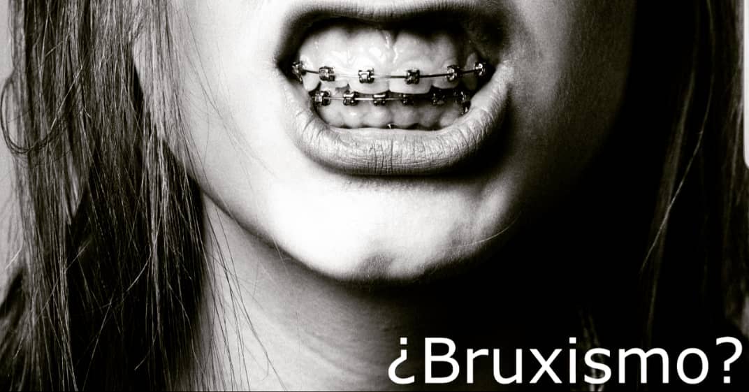 Qué es el bruxismo? 🧐 Sabías que existe más de una forma de bruxismo? 🤔 En la siguiente página encontrarás mayor información 👇
www.dolorfacialsur.cl/que-es-el-bruxismo
Link en el perfil 💻📱 #bruxismochile #bruxismo #ttmydof #dolororofacial #orofacialpain #temuco #angol #valdivia #notodoesbruxismo