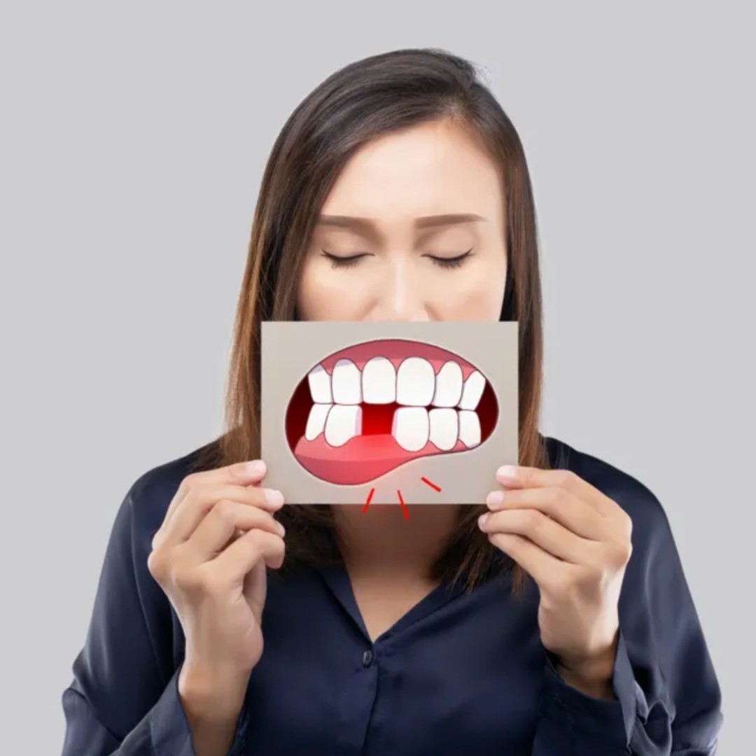 Missing teeth can lead to more than just a confidence gap – the loss of a tooth's root can result in bone density reduction. But fear not! At Panhandle Oral Surgery, we are here to guide you to a healthier, more confident smile! #POMS