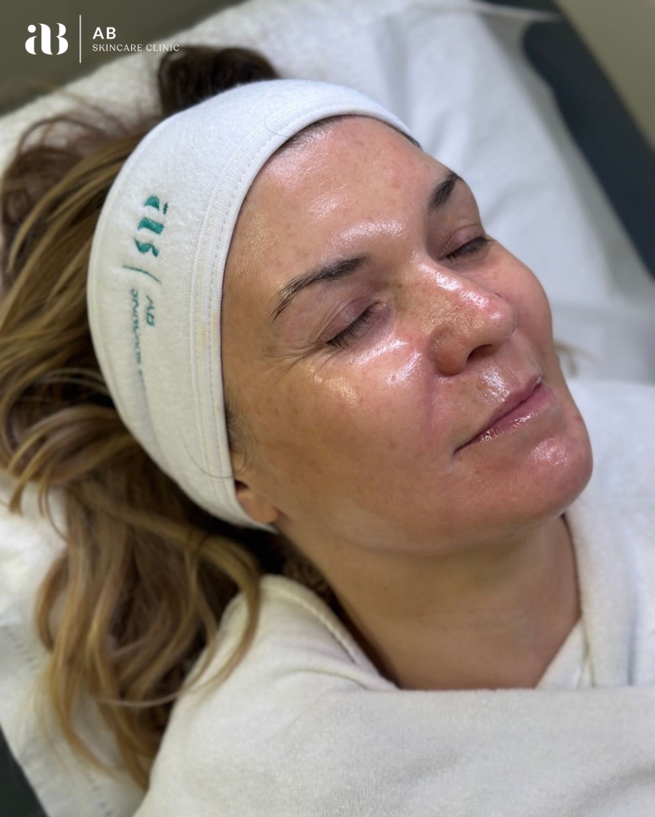 Not all chemical peels are created equal.
Image Skincare Peels stand out because they are 𝗽𝗿𝗼𝗳𝗲𝘀𝘀𝗶𝗼𝗻𝗮𝗹𝗹𝘆 𝗳𝗼𝗿𝗺𝘂𝗹𝗮𝘁𝗲𝗱 to deliver real results safely, while nurturing your skin’s health.
💎 𝙈𝙚𝙙𝙞𝙘𝙖𝙡-𝙜𝙧𝙖𝙙𝙚, 𝙮𝙚𝙩 𝙜𝙚𝙣𝙩𝙡𝙚 – Designed for effectiveness without unnecessary irritation
💎 𝘾𝙪𝙨𝙩𝙤𝙢𝙞𝙯𝙚𝙙 𝙨𝙤𝙡𝙪𝙩𝙞𝙤𝙣𝙨 – Targeting pigmentation, acne, fine lines, and dullness
💎 𝘼𝙙𝙫𝙖𝙣𝙘𝙚𝙙 𝙖𝙘𝙩𝙞𝙫𝙚 𝙞𝙣𝙜𝙧𝙚𝙙𝙞𝙚𝙣𝙩𝙨 – Vitamin-rich, antioxidant-packed, and clinically tested
💎 𝙈𝙞𝙣𝙞𝙢𝙖𝙡 𝙙𝙤𝙬𝙣𝙩𝙞𝙢𝙚 – Reveal smoother, brighter skin without disrupting your lifestyle
Experience the science of skincare combined with the luxury of visible transformation. A superior approach to your skins rejuvenation.
📅 Book your peel treatments today and see the difference yourself.
AB Skincare Clinic
📍Talbot Green
📧april@abskincareclinic.co.uk
📲07763047220