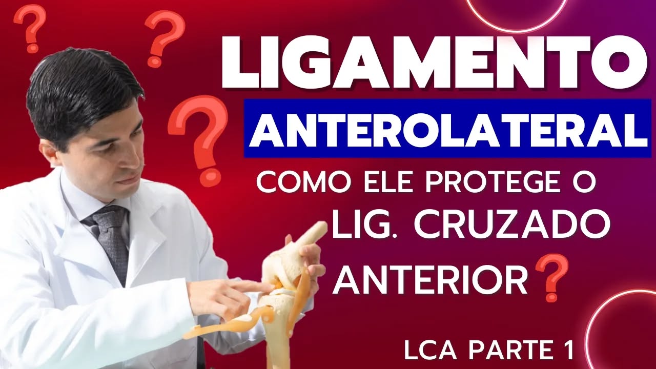 Novo video do Dr Mauricio Iamaguchi no youtube
COMO O LIGAMENTO ANTEROLATERAL DO JOELHO PROTEGE O LIGAMENTO CRUZADO ANTERIOR (LCA)?
RECONSTRUÇÕES EXTRA ARTICULARES ANTEROLATERAIS DO JOELHO ASSOCIADAS A RECONSTRUÇÃO DO LIGAMENTO CRUZADO ANTERIOR PODEM DIMINUIR O RISCO DE RE-LESÃO DO LIGAMENTO CRUZADO ANTERIOR EM ATÉ 3X EM CASOS SELECIONADOS COMPARADOS A RECONSTRUÇÃO ISOLADA DO LCA.