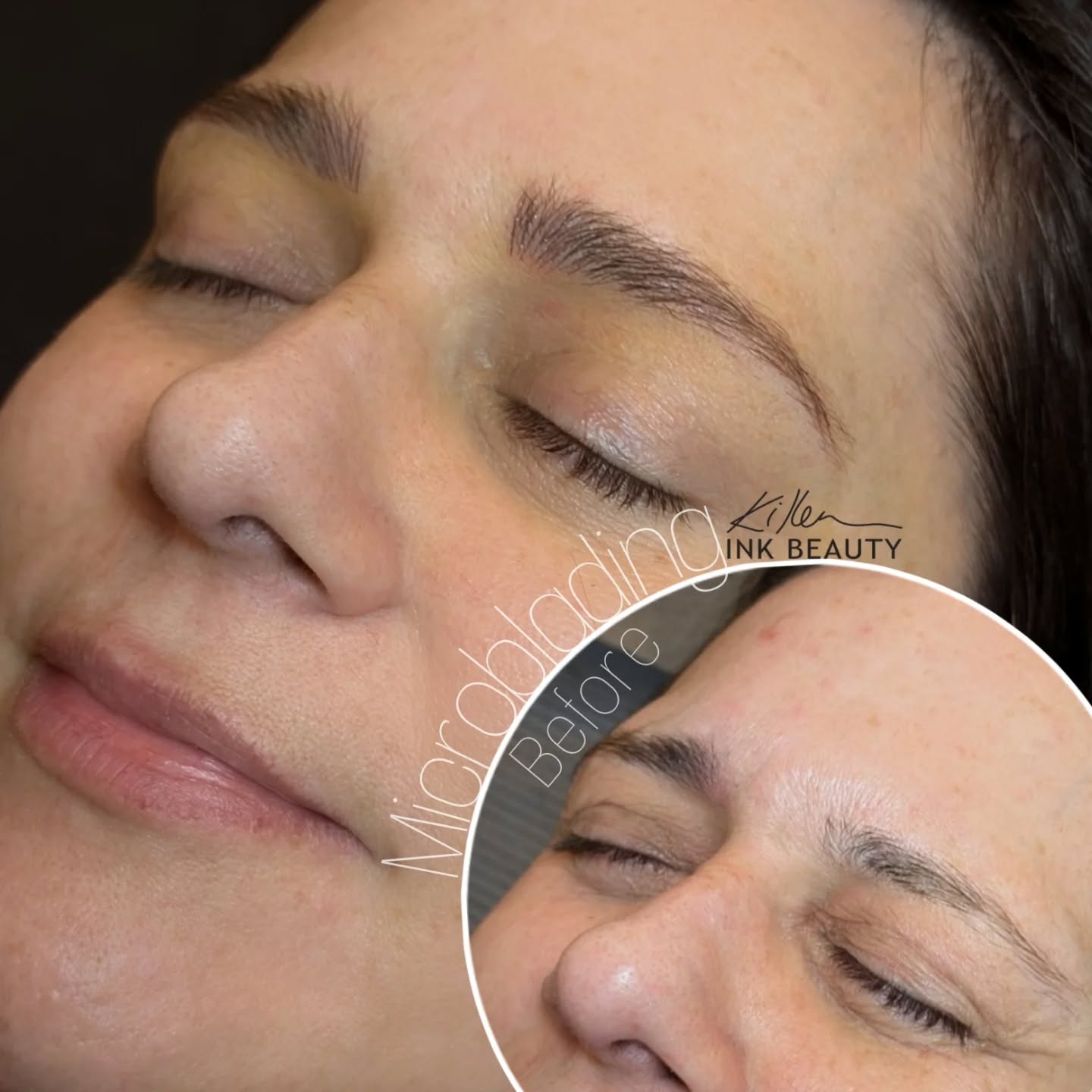 ✨ Soft & Natural ✨ Transforming brows one stroke at a time! This gorgeous before-and-after showcases the power of microblading for a flawless, natural look. 🖌️ Perfectly tailored to enhance your beauty while keeping it effortless. Ready for your brow glow-up? 💕
📍 Calgary & Vancouver Area
💌 DM to book your consultation!
#MicrobladingCalgary #MicrobladingVancouver #SoftNaturalBrows #BrowTransformation #CosmeticTattooing #FlawlessBrows #MicrobladingExpert #NaturalBeauty #EffortlessBrows #BrowGoals