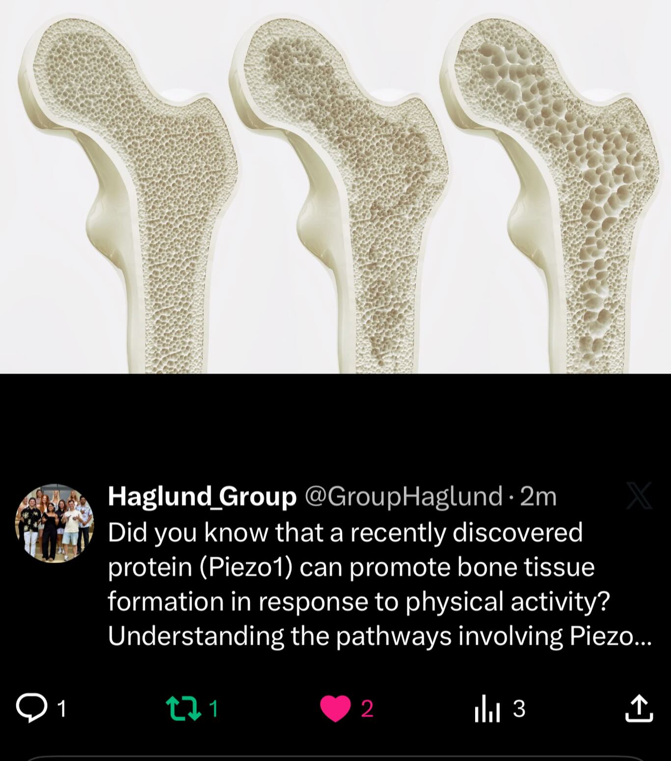 Did you know that a recently discovered protein (Piezo1) can promote bone tissue formation in response to physical activity? Understanding the pathways involving Piezo1 may lead to drugs that can simulate exercise to encourage bone strengthening to treat people with osteoporosis.
Reference: https://www.sciencedaily.com/releases/2026/01/260127010149.htm
#afunFactFriday