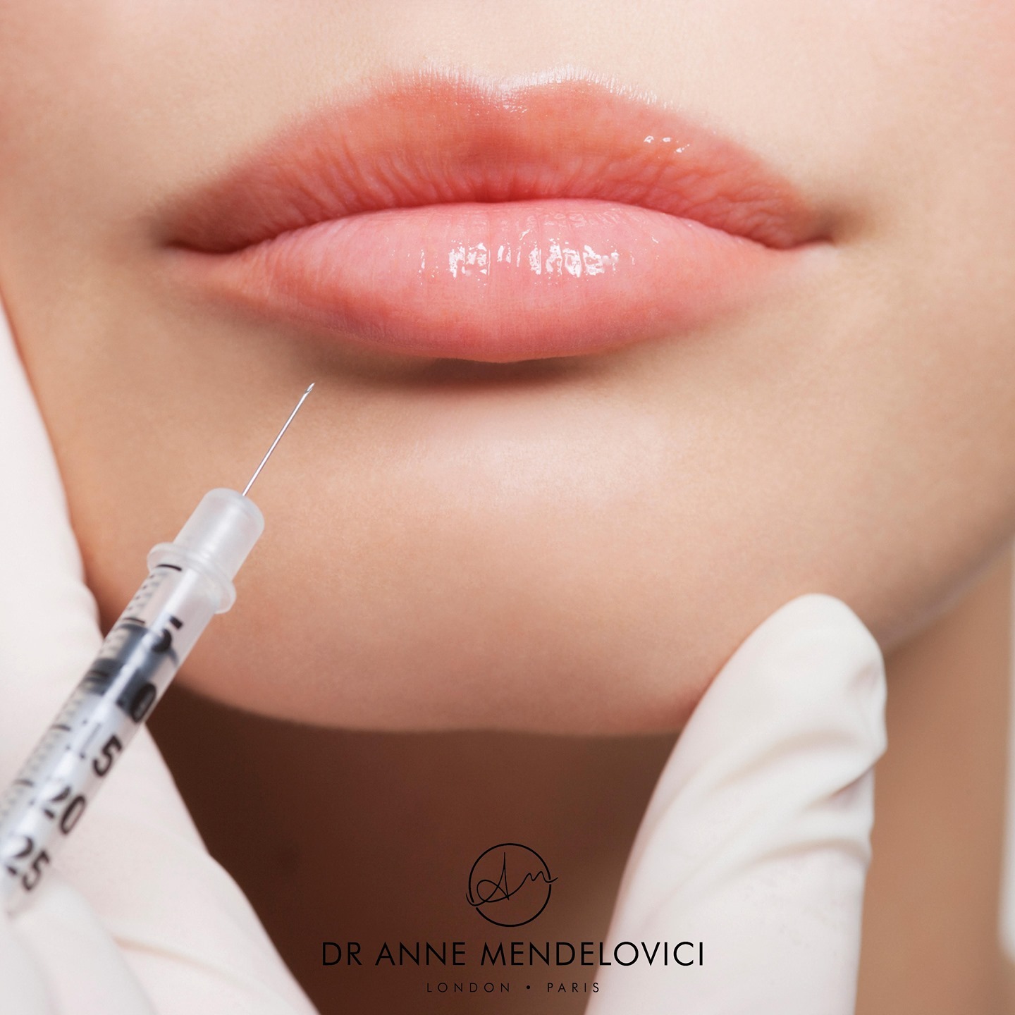 Lip Injection is one of our most popular treatment 💋
Lip fillers are the perfect way to add volume and plumpness to lips which may be lacking in shape or elasticity.
- Increases fullness of thin lips.
- Enhances lip definition
- Creates a more defined smile
- Give the mouth area a youthful, rejuvenated appearance
During your complimentary consultation @drmendelovici will answer any questions you may have and will talk you through the procedure.
Treatment starts at £300
More on www.drmendelovici.com 💫