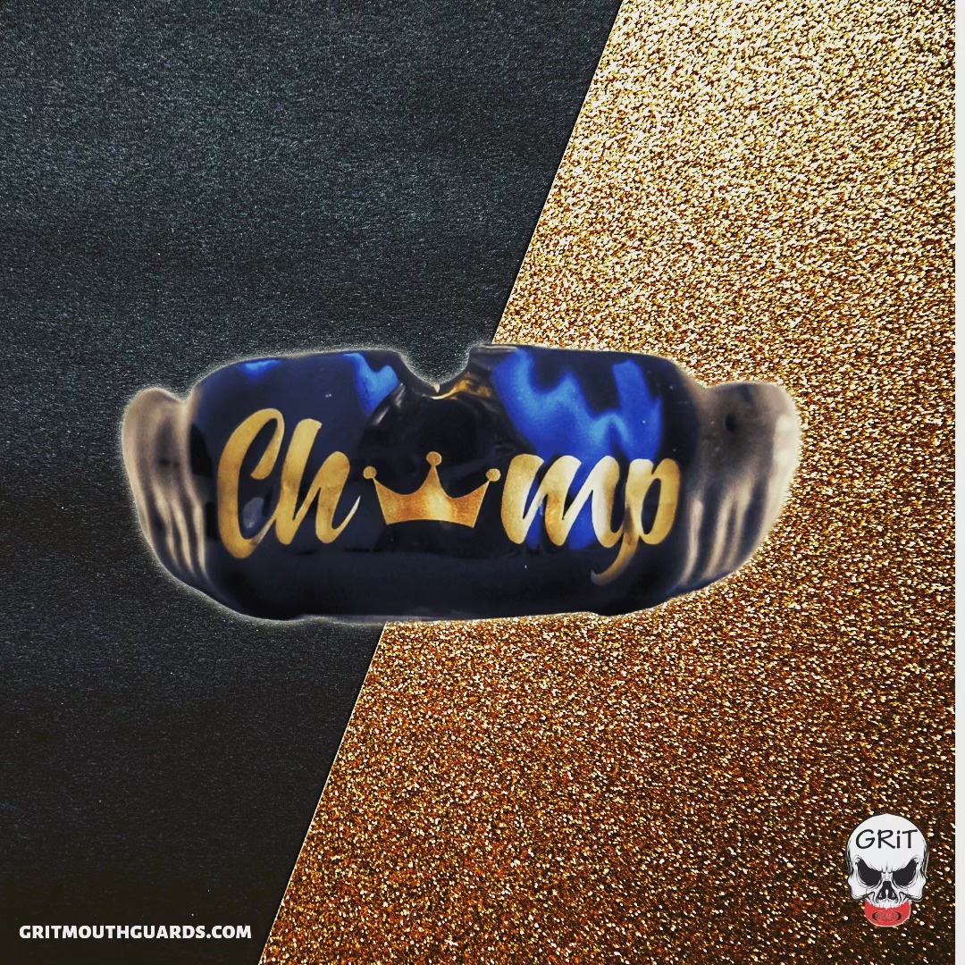 Champ custom mouthguard for @chuckbuffalomma! #champ #gritmouthguards #mouthguards #ufc
gritmouthguards.com