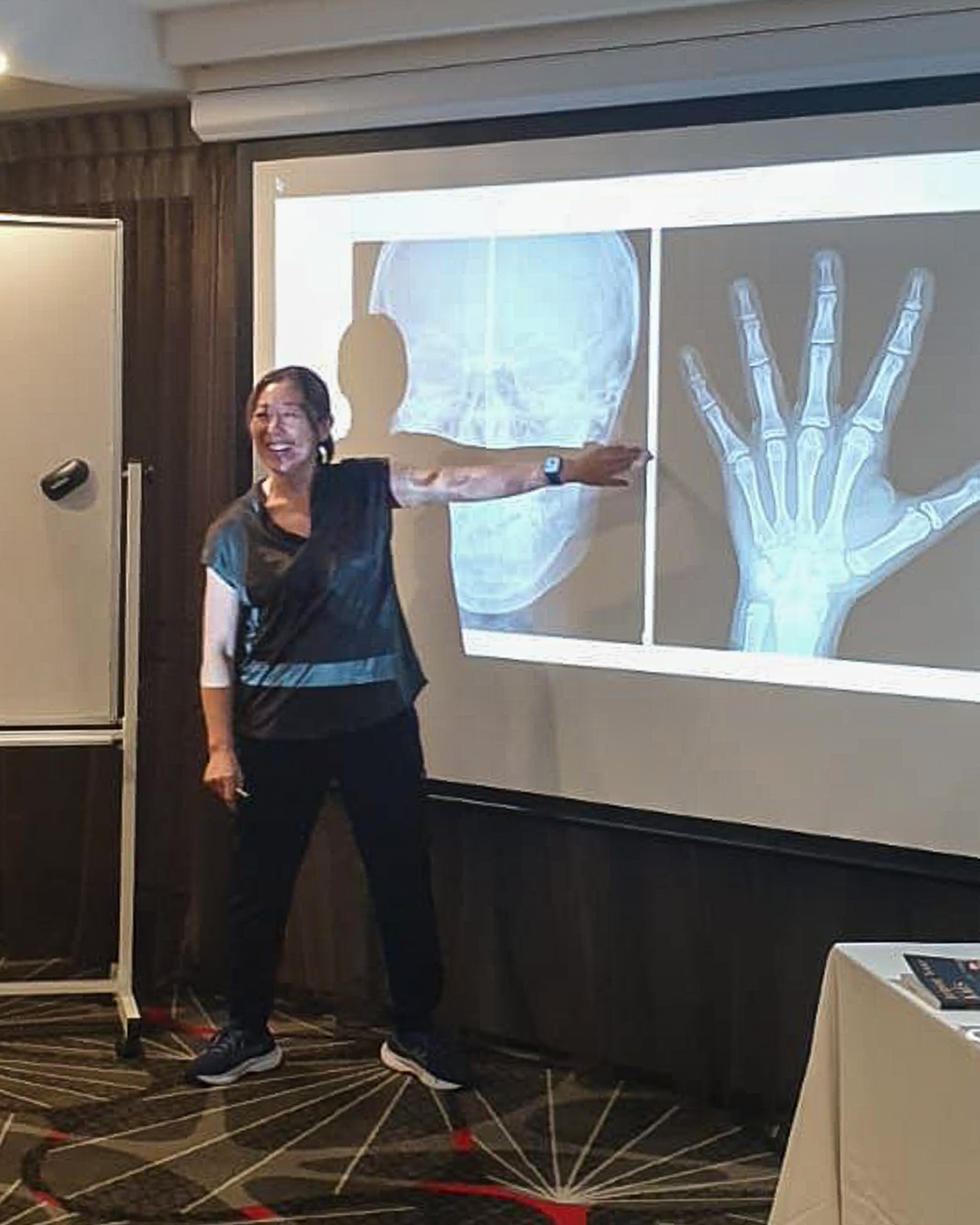 Last weekend, we welcomed the folks from Sydney #25 back for Seminar #4 with Dr. Campbell Roberts. New instructor, Dr. Sue Jean Lee, also presented a case to the class!
It was wonderful to see all of our doctors engaging with #orthodontics and to see all the progress this class has made!
