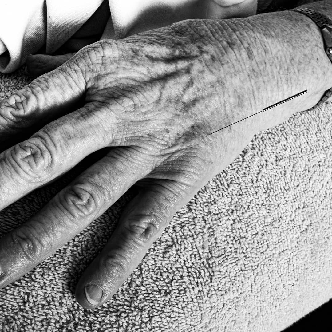 Acupuncture for the young and old