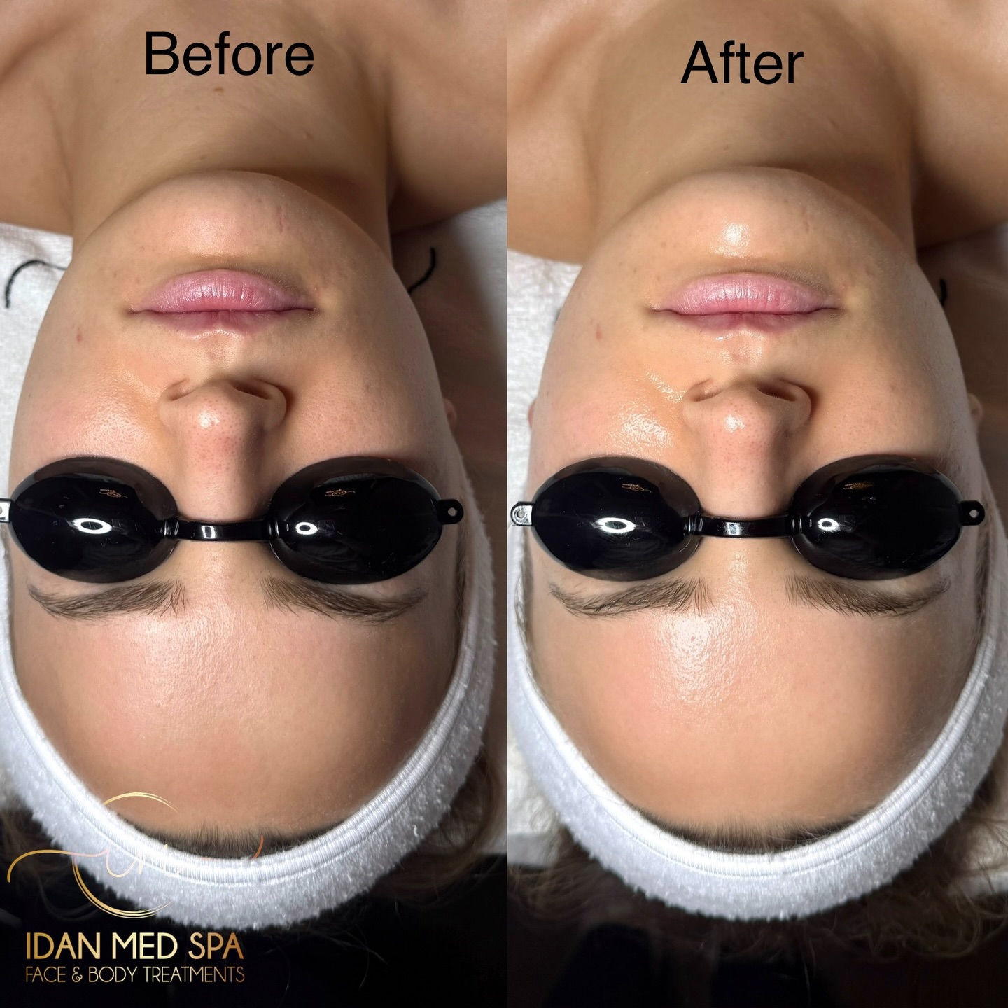 Glow deeper. Repair smarter.
Our Salmon DNA Facial helps stimulate collagen, improve texture, and restore that youthful radiance your skin deserves.
Stronger skin barrier.
Smoother texture.
Healthy glow from within.
Book your appointment today at Idan Med Spa 💎
#SalmonDNAFacial #SkinRejuvenation #CollagenBoost #GlassSkin #LuxuryFacial MedicalSpa EncinoMedSpa SanFranciscoMedSpa HealthyGlow SkincareExperts IdanMedSpa