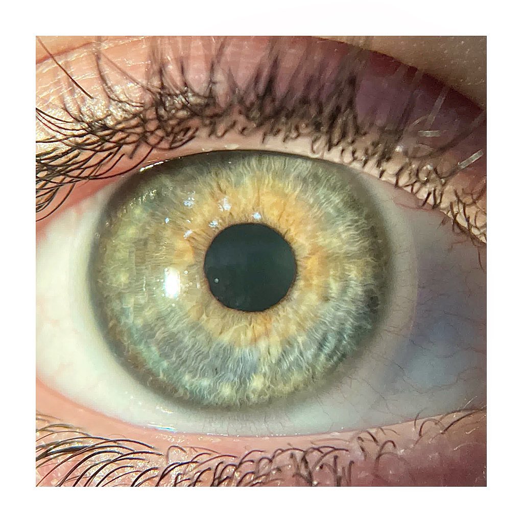 N A T U R E 👁 Nous sommes spécialisés en lentilles de contact #wearevisionspecialists #weareoptometrists #readingdifficulties #examendevie 😁#visionforlife #reichertvrx #optometriste #strasbourg #opticien #derhy #myopiacontrol #lesopticienseyelike