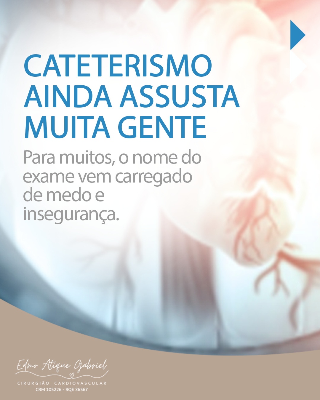 O cateterismo ainda é visto por muitos como algo assustador, quando, na verdade, representa uma das maiores conquistas da cardiologia moderna.
Ele permite enxergar com segurança, precisão e rapidez o que está acontecendo dentro do coração. E, em muitos casos, o procedimento vai além do diagnóstico: o problema pode ser resolvido no mesmo instante, evitando cirurgias maiores e reduzindo complicações.
Cateterismo não é uma sentença.
É solução, é tecnologia, é cuidado menos invasivo e mais humano.
Entender o exame é o primeiro passo para enfrentar o medo com confiança.
Informação também salva vidas.
Dr. Edmo Atique Gabriel - Cardiologista e Cirurgião Cardiovascular
#Cateterismo #CardiologiaModerna #SaúdeDoCoração #CoraçãoSaudável #Prevenção #TecnologiaEmSaúde #MedicinaAvançada #CuidadosCardíacos #InformaçãoSalvaVidas #DrEdmoAtiqueGabriel