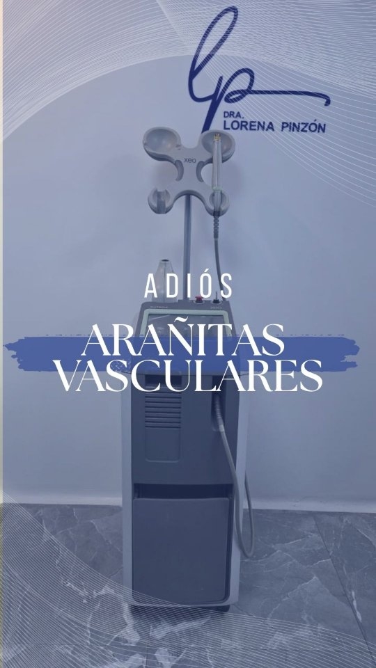 Estas preparad@ para eliminar esas molestas arañitas vasculares en piernas o rostro?
El láser vascular es tu mejor y mas segura opción, resultados inmediatos y duraderos, sin incapacidades...
Asombroso no crees?
Preguntanos si tienes dudas y con gusto te responderemos y comparte para que tu mamá, prima, tía o amiga se entere que si hay opciones para lucir unas piernas sanas y bellas!!
#laservascular #láservascularbogotá #laservascularbogota #arañitasvasculares