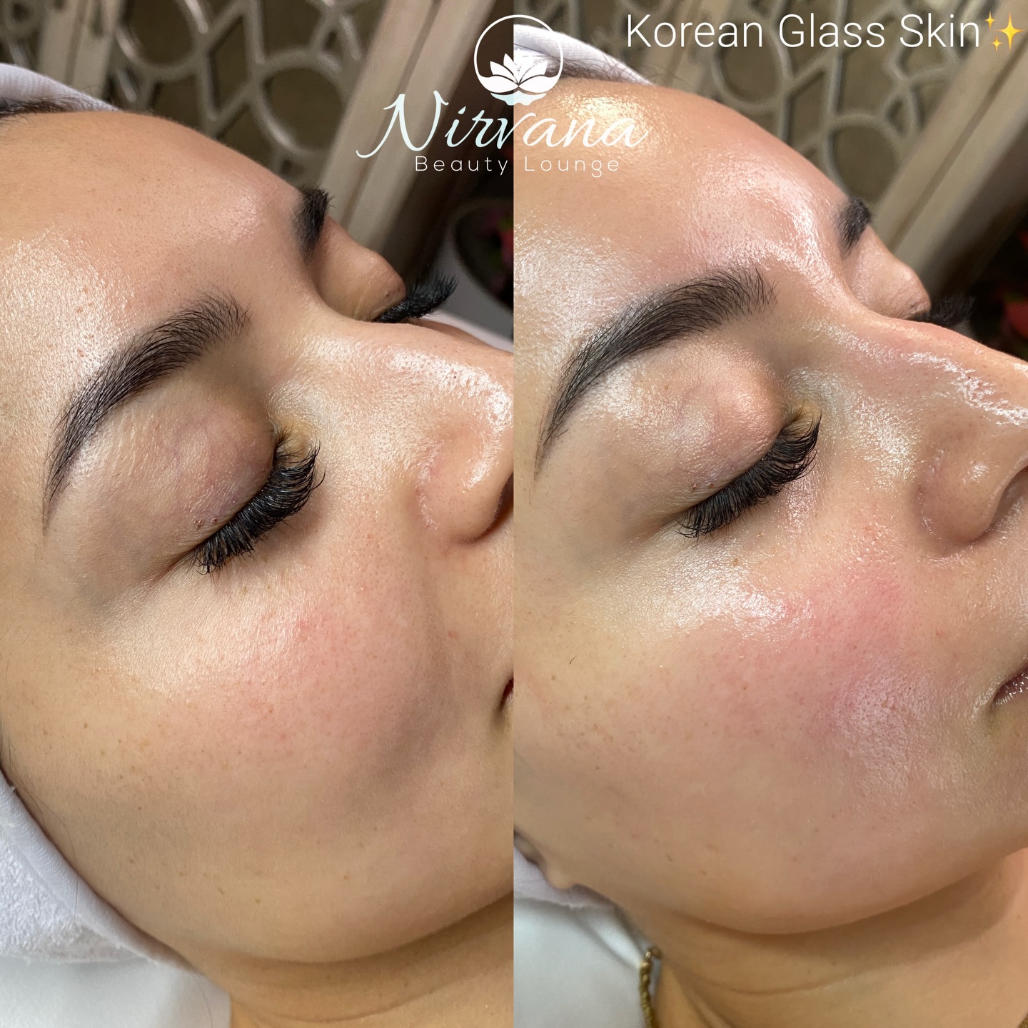 Experience the transformative power of our ๐ฒ๐๐๐๐๐ ๐ฎ๐๐๐๐ ๐บ๐๐๐ ๐ญ๐๐๐๐๐ โ the signature treatment designed to deliver:
โจ
๐ง ๐ซ๐๐๐ ๐ฏ๐๐
๐๐๐๐๐๐
A moisture-infusion that quenches thirsty skin at its core, leaving your complexion luminous, dewy, and healthy-looking.
๐ซง ๐ฝ๐๐๐๐๐๐ ๐ท๐๐๐๐๐๐๐
Advanced ingredients and expert techniques boost elasticity and volume, smoothing fine lines and giving your skin a youthful, supremely supple texture.
โจ ๐ต๐๐๐๐๐๐ ๐ช๐๐๐๐๐๐๐๐๐
We sculpt and refine with precision, enhancing your features and promoting a lifted, radiant silhouette โ without invasive procedures.
๐พ๐๐ ๐๐ ๐พ๐๐๐๐
Our facial blends traditional Korean beauty wisdom with cutting-edge skincare technology and ingredientsโ for results you can see and feel:
โ Skin looks refreshed, brighter, and more sculpted
โ Hydration lasts long after the treatment
โ Your natural glow becomes irresistibly glass-like
โจ
๐ท๐๐๐๐๐๐ ๐๐๐
โจ Dull or dehydrated skin
โจ Early signs of aging
โจ Anyone craving a luminous, youthful complexionโจ
๐บ๐๐๐๐๐๐ ๐ท๐๐๐๐ $185 (๐น๐๐.$245)
More Info & Booking:
www.nirvanatx.com/skin
Text/Call to Book:
๐ฑ 361-877-5162ย
๐ 101 N Shoreline Blvd Suite 101โจ
โจ
#koreanglassskin
#koreanfacials
#koreanskincarecorpuschristi
#facialscorpuschristi
#koreanskincorpuschristi