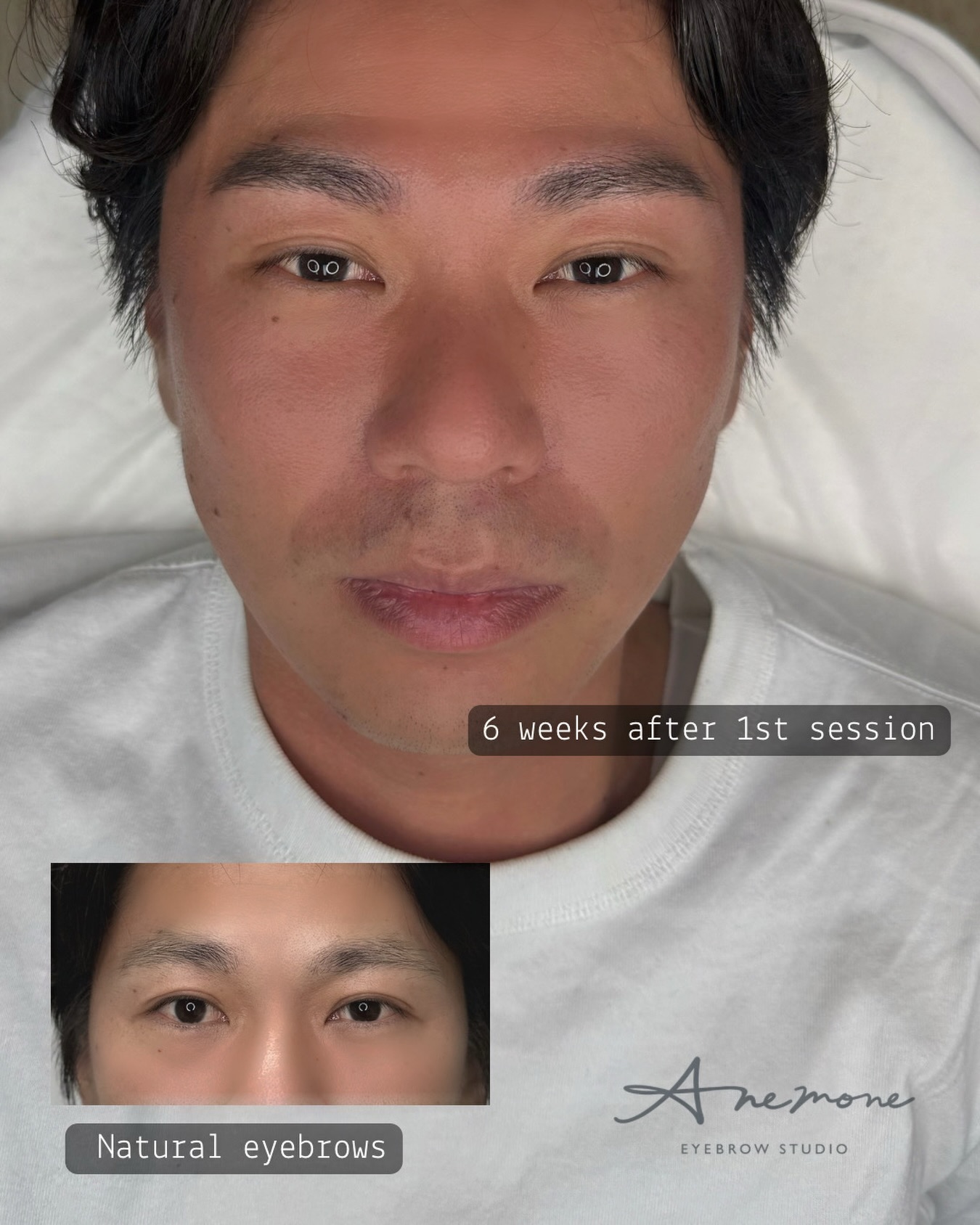 眉を整えるだけで
・お顔がはっきりする
・疲れて見えにくくなる
・第一印象が変わります✨
初めてのアートメイクは
やりすぎないのがおすすめ。
無料カウンセリングのみのご予約も可能です。
■Hair stroke for men
■Price
First session 10,000B
Second session 6,000B
■🙅♀️Please avoid sweating and exercise for one week
■The required time
1.5h
■Reservation
OfficiaLINE @anemonebk