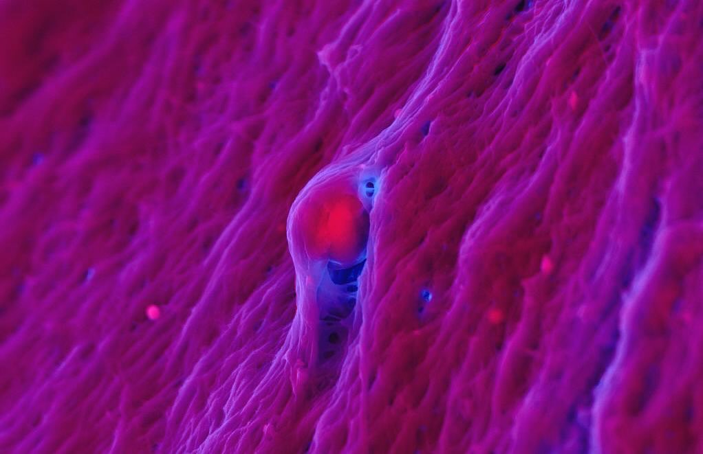 Cardiac calcification
#science #electronmicroscope #laboratory #scienceart #sciencephoto #scientific #scienceweek #research #lab #micro #microscope #microscopy #medicine #medicalsciencestudent #medicalstudent #macrophotography #mineralomics #bio #biology #bioimaging #biologylab #minerals #chemistry #material #engineering #physics #sciencecommunication #ucl #DDCSEM #Mineralomics