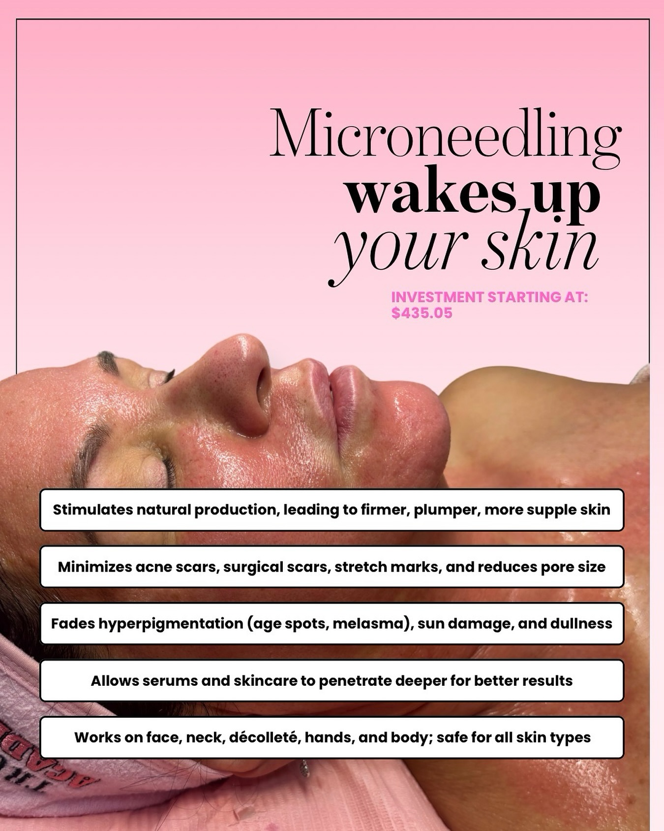 Microneedling wakes up your skin. ✨
Microneedling creates controlled micro-channels in the skin to trigger your body’s natural healing response and stimulate collagen + elastin production. But preparation and aftercare matter just as much as the treatment itself.
Pre-care: avoid retinol, exfoliants, and active acids 3–5 days before, no sunburn, and come hydrated with clean skin.
Post-care: keep the skin hydrated, avoid makeup for 24 hours, no workouts/heat for 24–48 hours, avoid active ingredients for about 5–7 days, and wear SPF daily. During the first week, expect redness (like a mild sunburn) for 24–48 hours, possible tightness, dryness, light flaking around days 3–5, and then that fresh, glowy skin starting to come through. Collagen continues building for weeks after.
For best results, treatments are typically done every 4–6 weeks in a series of 3–6 sessions depending on your skin goals.
And when you pair it intentionally? That’s when the results elevate 👇🏽
💧 PDRN (Salmon DNA / regenerative serums) – Infused during or immediately after treatment, PDRN supports cellular repair, accelerates healing, reduces inflammation, and enhances collagen stimulation. With the micro-channels open, absorption is maximized — meaning deeper repair and faster glow.
🪒 Dermaplaning – Performed before microneedling, it removes dead skin and vellus hair so product penetration is more even and results are smoother. It enhances that glass-skin finish and helps the treatment work uniformly.
💉 Mesotherapy – Custom blends of vitamins, peptides, and brightening ingredients delivered alongside microneedling to target concerns like pigmentation, dullness, dehydration, and aging. This is where treatment becomes fully personalized and corrective.
💡 LED Light Therapy – Post-treatment LED reduces inflammation, speeds healing, and boosts collagen production — perfect for minimizing downtime and enhancing results.
Collagen stimulation. Cellular repair. Real skin remodeling.