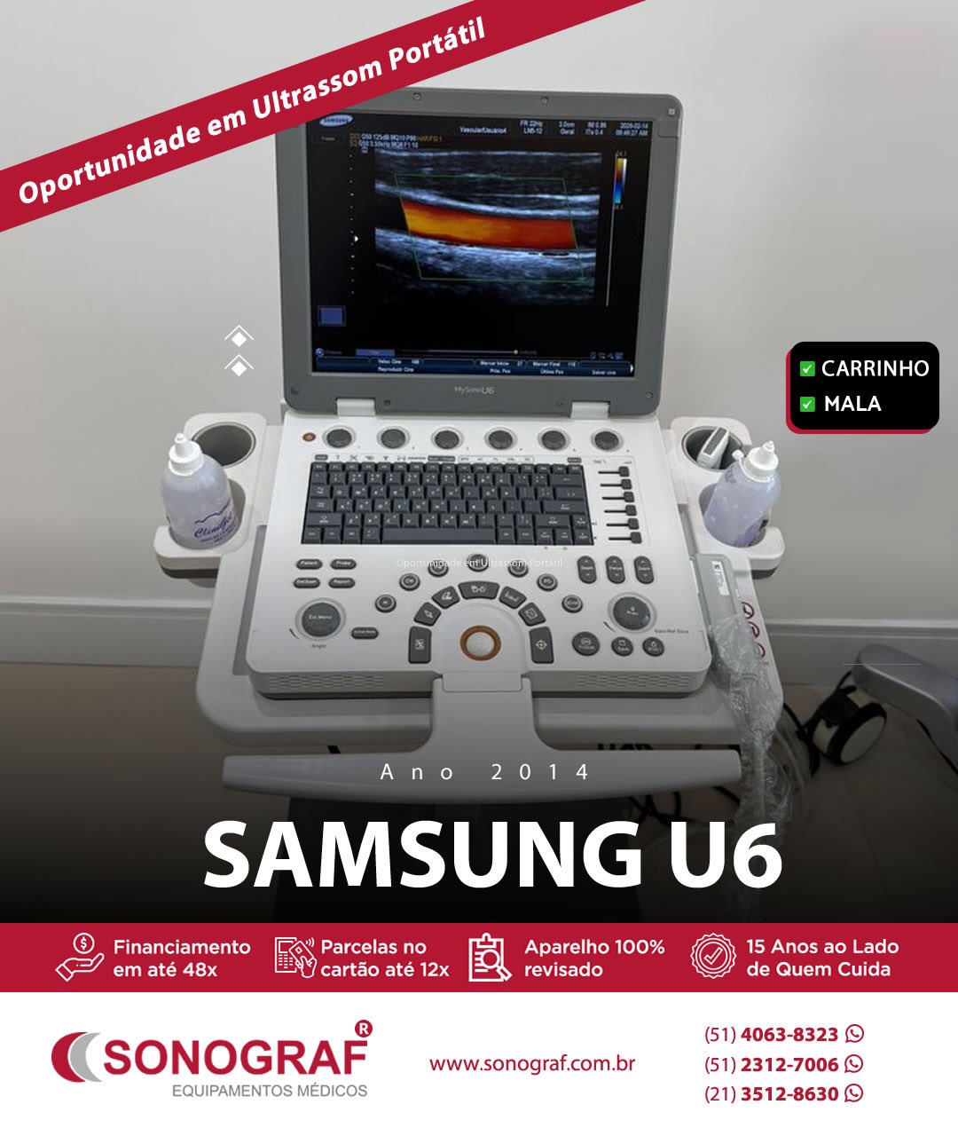 Samsung U6: eficiência, qualidade de imagem e excelente custo-benefício.
✔ Imagem nítida
✔ Interface intuitiva
✔ Recursos avançados em um equipamento compacto
✔ Marca consolidada no mercado
Se você busca performance com investimento inteligente, o Samsung U6 é uma decisão estratégica.
#ultrassom #sonografequipamentos #examesdeimagem #doppler