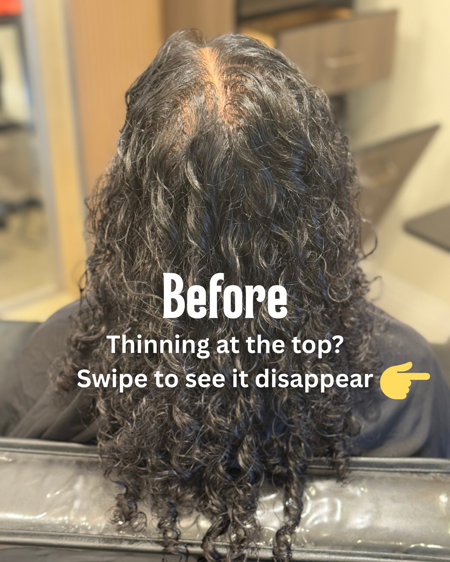 Stage one hair thinning?
You don’t need a full transformation. You just need a boost!
These lightweight cotton hair fibers blend seamlessly with your natural strands to fill in sparse areas, reduce scalp visibility, and create the look of thicker, fuller hair in seconds.
✔ Perfect for early thinning hair
✔ Instant volume and density
✔ Non surgical hair loss solution
✔ Safe for everyday wear
Small change. Big confidence.
DM us to see if hair fibers are the right solution for your hair goals.
#thinninghair #hairlosssolutions #hairfiber #volumeboost #hairlosscommunity