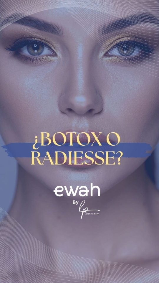Radiesse o Botox?, una pregunta que me hacen frecuentemente en el consultorio es si el radiesse y el botox sirven para lo mismo. La respuesta es No!!.
El Botox nos ayuda a relajar los musculos faciales, minimizando su contacción y así rediciendo las líneas de expresión.
Radiesse nos ayuda a regeneral el colageno perdido, mejorar tensión y calidad.
Aunque se recomienda con frecuencia la combinación de estos dos tratamientos, no aplica en todos los pacientes, generalmente los pacientes jovenes, que aún mantienen buena calidad de piel, no requieren radiesse.
Es importante consultar siempre con personal médico capacitado para determinar cuales son los tratamientos recomendados para cada caso en particular y para garantizar la seguridad en la aplicación del tratamiento.
Consulta en EWAH Experts on Wellness And Health, tu próximo tratamiento de medicina estética y antiedad.
#medicinaestetica #botox#radiesse #BotoxBogotá #radiessebogotá