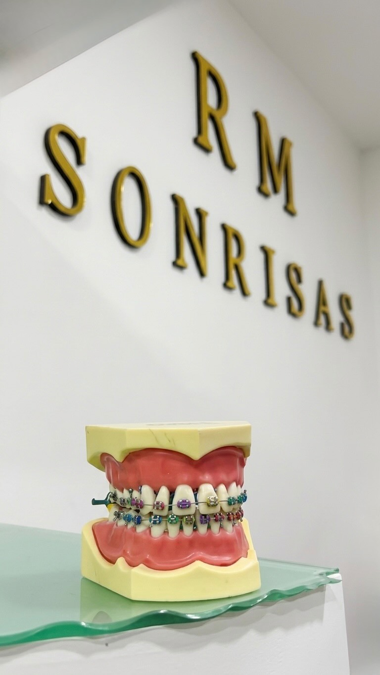 Hace cuánto no sonríes con total libertad? 🦷✨. Entendemos que ir al dentista no solo se trata de salud, sino de sentirte bien en un ambiente que te dé paz. Hemos diseñado un espacio donde la tecnología y el confort se encuentran para que tu única preocupación sea elegir qué tan brillante quieres tu nueva sonrisa.
• ¿Qué te ofrecemos?
• Atención personalizada en instalaciones de vanguardia.
• Un ambiente relajado (¡adiós al miedo al dentista!).
• Expertos comprometidos con la estética y salud de tu boca.
📍 Visítanos y descubre por qué somos el lugar favorito de tantas familias.
¡Tu primera cita de valoración te espera! Escríbenos por DM o al WhatsApp 5579076408 / 5545811008#ortodoncia #brackets #diseñodesonrisa #sonrisa