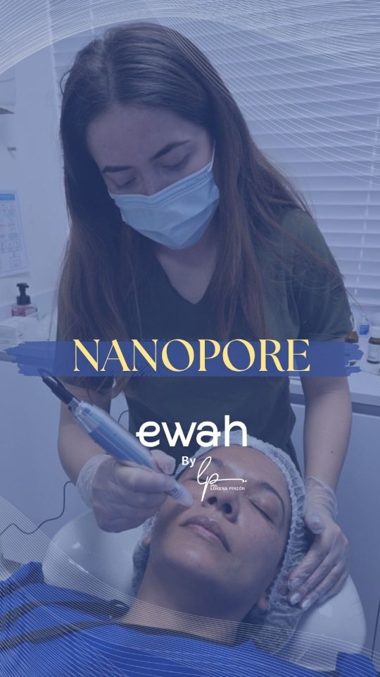 ¡Dale a tu piel el glow up que se merece sin sufrir en el intento! ✨ Te presentamos la revolución del rejuvenecimiento: Nanopore.
¿Por qué es el favorito de nuestras pacientes? 🤔
🛡️ Cero Maltrato, Máxima Seguridad: Utilizamos tecnología de micropunción con agujas de Titanio de grado médico. Son ultra finas, biocompatibles y estériles. No desgarran ni maltratan la capa externa de tu piel, garantizando una recuperación rápida y segura.
💧 Nutrición Profunda y Real: Nanopore crea miles de microcanales invisibles que permiten que nuestros potentes cócteles de vitaminas, ácido hialurónico y péptidos penetren profundamente donde tu piel realmente lo necesita. ¡Imagina multiplicar la absorción de tus sueros por 1000!
🌪️ Adiós Imperfecciones: Estimula naturalmente la producción de colágeno y elastina para suavizar arrugas, reducir poros, atenuar manchas y mejorar la textura general.
¿Lista para una piel de porcelana, hidratada desde adentro? 💖
📩 Envíanos un DM para agendar tu evaluación y descubrir lo que Nanopore puede hacer por ti.
#Nanopore #NanoporeNeedling #Microneedling #Microagujas #MedicinaEstetica CuidadoDeLaPiel RejuvenecimientoFacial Antiage AntiEvejecimiento