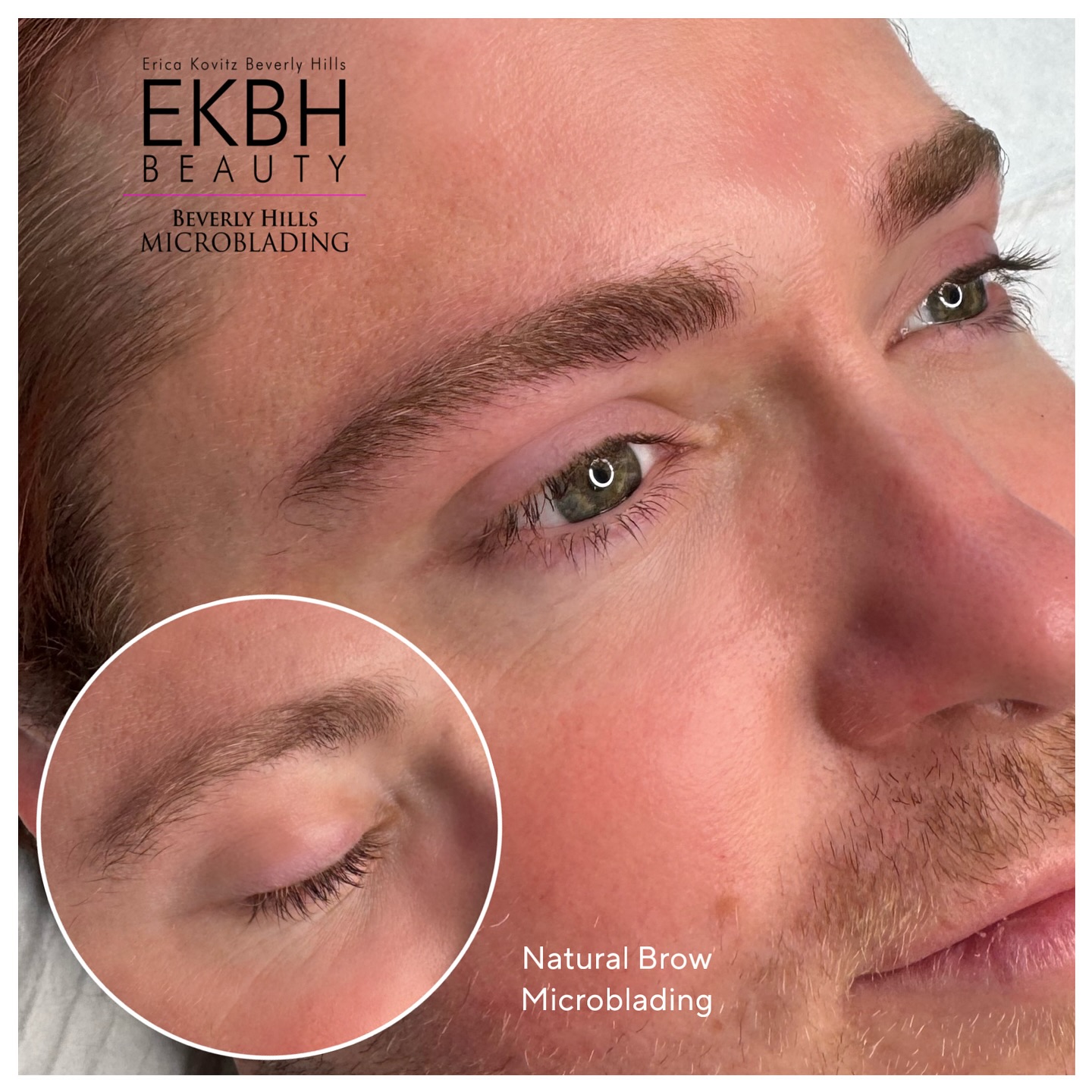 The best work is the work nobody notices. Natural male microblading, built stroke by stroke to give him the density he was missing. This is the art of subtlety.
#MaleMicroblading #MensBeauty #BrowsForMen #MicrobladeForMen #MenWithMicroblading