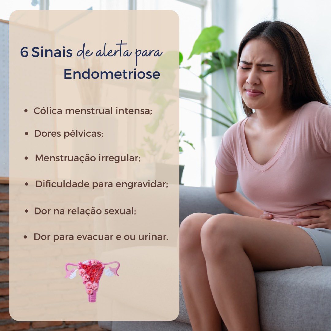 6 Sinais de alerta para Endometriose! 🚨
Você sabia que cerca de 10 a 15% das mulheres na idade fértil tem endometriose?
A endometriose é uma doença inflamatória crônica e progressiva, que acontece quando o endométrio (tecido que reveste a cavidade uterina) se implanta fora do útero.
Normalmente, ao final do ciclo menstrual, o endométrio costuma ser expelido do corpo por meio da menstruação. Uma das teorias que tenta explicar essa doença sugere que parte dessa menstruação vai para dentro do abdome e se implanta no peritônio, gerando dores intensas.
A endometriose é uma condição que pode ser muito dolorosa, causando sérias dificuldades e grandes impactos na vida da mulher afetada e seu diagnóstico tardio pode dificultar o tratamento.
Cuide do seu bem-estar! 💛
Dr. Lucas Martins
Ginecologista e Obstetra
CRM-SP 175.278 | TEGO 0190/2020 | RQE 92.996