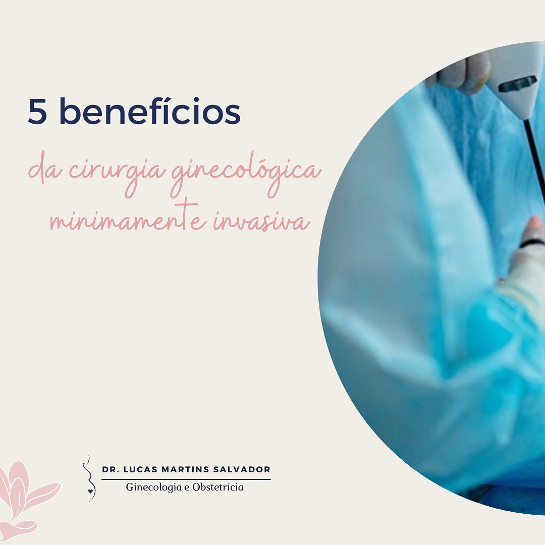 O avanço da tecnologia trouxe grandes benefícios a saúde da mulher com as cirurgias ginecológicas minimamente invasivas.
Entre as principais técnicas temos a videolaparoscopia e a histeroscopia, que com equipamentos de alta tecnologia e pequenas incisões (ou nenhuma) nos permite investigar e tratar o sistema reprodutor feminino proporcionando grandes benefícios à saúde e bem-estar da mulher.
✅ Arrasta pro lado e confira 5 benefícios da cirurgias ginecológicas minimamente invasivas!
Dr. Lucas Martins
Ginecologista e Obstetra
CRM-SP 175.278 | TEGO 0190/2020 | RQE 92.996