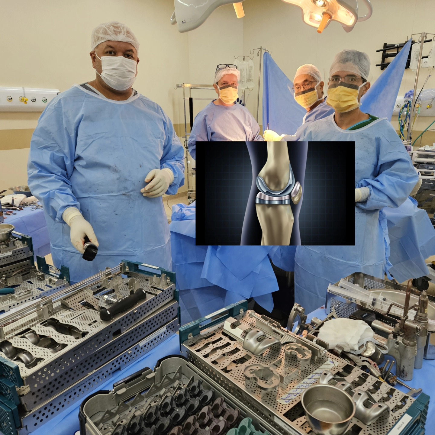 Semana do Dr Maurício Iamaguchi (Especialista em Cirurgia do Joelho) com cirurgias diversas: Próteses totais do joelho; Artroscopias do Joelho; Reconstruções do Ligamento cruzador anterior e do ligamento anterolateral; Reconstrução do ligamento colateral medial; Sutura de Lesão da raiz posterior do menisco medial; Sutura de lesão em alça de balde do menisco
E também em hospitais diversos: Hospital Sírio libanes; Hospital Albert Einstein; Hospital Samaritano e Hospital Sancta Maggiore Dubai da Prevent Sênior (Como médico externo)