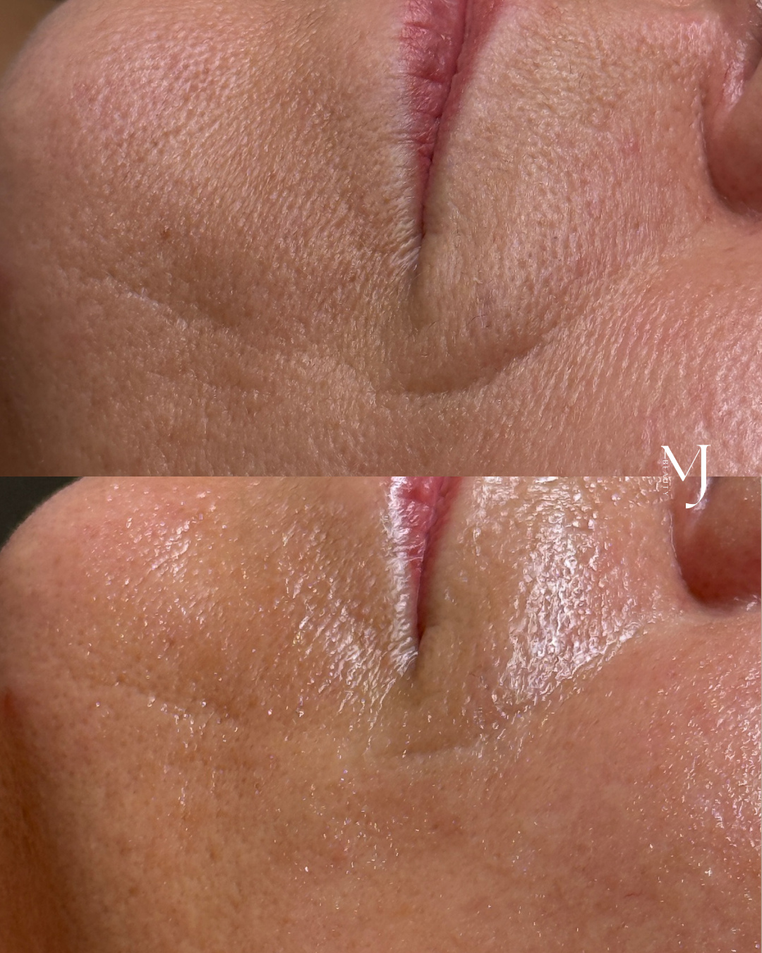 Turn back the clock, without needles or downtime â¨â
â
The Qi Beauty Facial combines Traditional Chinese Medicine meridian principles with 24ct gold-plated micro-magnets to stimulate circulation, boost collagen and support your skinâs natural regeneration. â
â
The result? Softer fine lines, smoother texture and a lifted, radiant complexion that glows from within.â
â
Itâs the non-invasive way to reduce the appearance of wrinkles while nourishing your skin at a deeper, holistic level. đ¤â
â
Book your appointment today đ