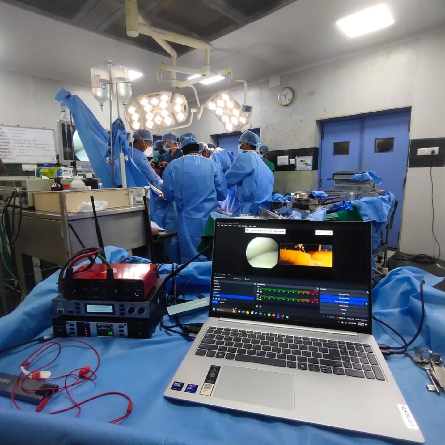 Not many people know this… but behind the lights, music, and celebrations — there’s a whole other side to what we do.
At MADE Creative Works, we don’t just create beautiful weddings, birthdays, and social events — we also operate in high-precision, high-responsibility environments like medical conferences and live surgery relays.
From seamlessly transmitting live surgeries from operation theatres to conference halls, to ensuring zero-lag, high-definition feeds for hundreds of delegates — this is where creativity meets technical excellence.
These aren’t just events.
They’re moments where knowledge is shared, skills are demonstrated, and lives are impacted.
Being trusted with something this critical is not just work for us — it’s a responsibility we take seriously.
So the next time you see us setting up a stunning celebration, just know…
we’re also the team that can handle a live surgery broadcast with the same precision.
One team. Multiple worlds. Same commitment to excellence.
#madecreativeworks #madeinbelgaum #livesurgery #medicalconference #camerawork