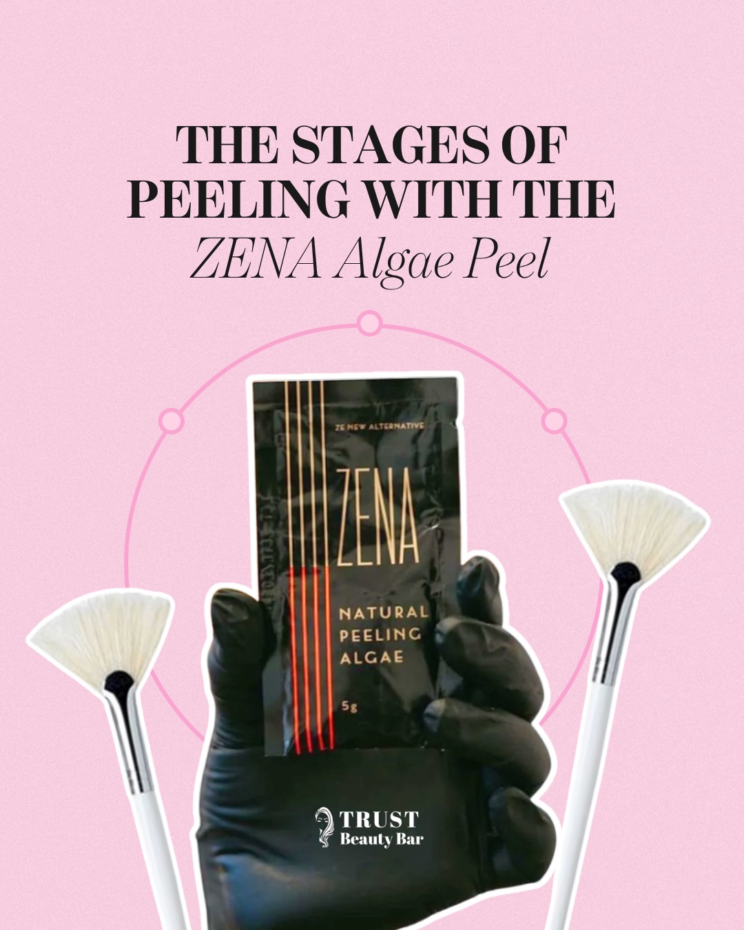 ✨ 𝐓𝐇𝐄 𝐓𝐑𝐔𝐓𝐇 𝐀𝐁𝐎𝐔𝐓 𝐓𝐄𝐗𝐓𝐔𝐑𝐄𝐃 𝐒𝐊𝐈𝐍 ✨
If you’re dealing with 𝐤𝐞𝐫𝐚𝐭𝐨𝐬𝐢𝐬 𝐩𝐢𝐥𝐚𝐫𝐢𝐬 (𝐊𝐏), body acne, or stubborn roughness… this is your sign.
What you’re seeing here is controlled peeling with the ZENA Algae Peel — not damage, not dryness… but cellular renewal in action.
⸻
💡 𝐖𝐇𝐀𝐓 𝐈𝐒 𝐊𝐄𝐑𝐀𝐓𝐎𝐒𝐈𝐒 𝐏𝐈𝐋𝐀𝐑𝐈𝐒?
A common condition where keratin builds up and blocks hair follicles, creating:
• Small rough bumps
• “Chicken skin” texture
• Dry, uneven tone
Most people try to scrub it away… but that actually makes it worse.
⸻
🧬 𝐇𝐎𝐖 𝐓𝐇𝐄 𝐙𝐄𝐍𝐀 𝐀𝐋𝐆𝐀𝐄 𝐏𝐄𝐄𝐋 𝐖𝐎𝐑𝐊𝐒
This isn’t your typical superficial peel.
It works by:
• Stimulating accelerated cell turnover
• Softening and releasing keratin plugs
• Triggering skin regeneration + repair
• Detoxifying pores + reducing inflammation
⸻
🔥 𝐏𝐄𝐑𝐅𝐄𝐂𝐓 𝐅𝐎𝐑:
• Keratosis Pilaris (arms, legs, glutes)
• Body acne + congestion
• Back acne / chest acne
• Facial breakouts + texture
• Dull, uneven skin tone
⸻
⏳ 𝐓𝐇𝐄 𝐏𝐄𝐄𝐋𝐈𝐍𝐆 𝐏𝐇𝐀𝐒𝐄 (𝐃𝐀𝐘 𝟏–𝟕)
• Days 1–2: Tight, slightly warm skin
• Days 3–5: Visible shedding begins
• Days 5–7: Fresh, smoother skin revealed
Yes — the peeling looks intense… but the results? Next level.
⸻
✨ 𝐑𝐄𝐒𝐔𝐋𝐓𝐒:
• Smoother, refined texture
• Clearer, less congested skin
• Reduction in KP + breakouts
• Brighter, healthier glow
⸻
⚠️ 𝐏𝐑𝐎 𝐓𝐈𝐏:
Do NOT pick or prematurely exfoliate — let the skin shed naturally for optimal results.
⸻
📍 Available at TRUST Beauty Bar
📲 Book your consultation — your skin will thank you.
⸻
#KeratosisPilaris #BodyAcne #SkinPeel #ZenaPeel #SkinTexture AcneTreatment TorontoMedSpa TrustBeautyBar GlowingSkin SkinEducation