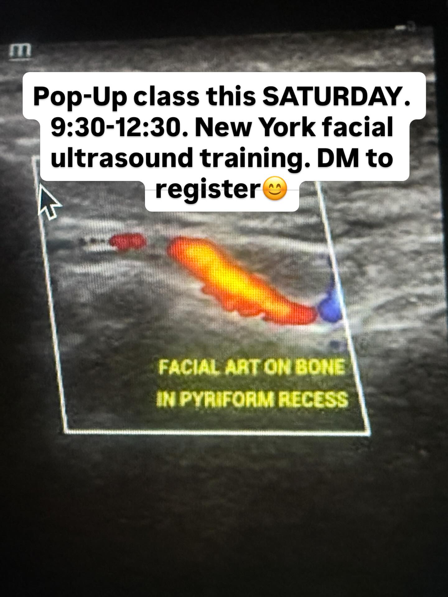 Hands-on training! Open to all medical professionals. We won’t make you an ultrasonographer, but we will show you how to do a facial ultrasound and read it!!
#FacialUltrasound #aestheticinjector #newyorkaesthetic #nurseinjector #medspa