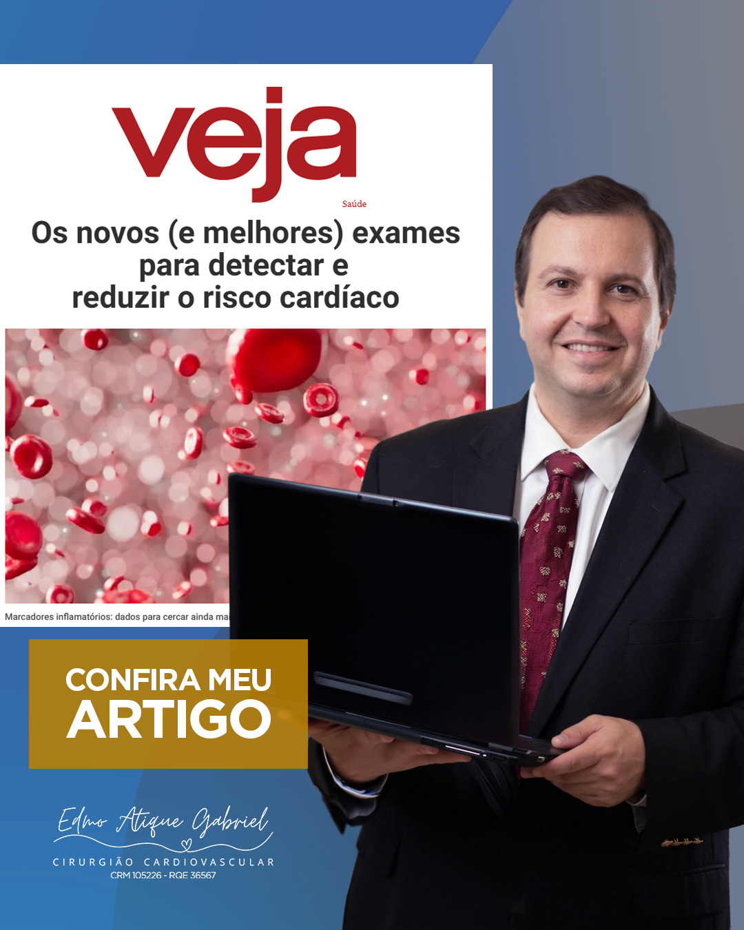 Meu novo artigo na Veja Saúde já está disponível! 🚀🩺
Analiso como as novas tecnologias e exames de última geração são fundamentais para detectar e, principalmente, reduzir o risco cardíaco de forma eficaz. A informação de qualidade é, sem dúvida, o primeiro passo para uma vida longa e saudável.
#Medicina #Cardiologista #Saúde #ArtigoCientífico #DrEdmoAtiqueGabriel #VejaSaúde