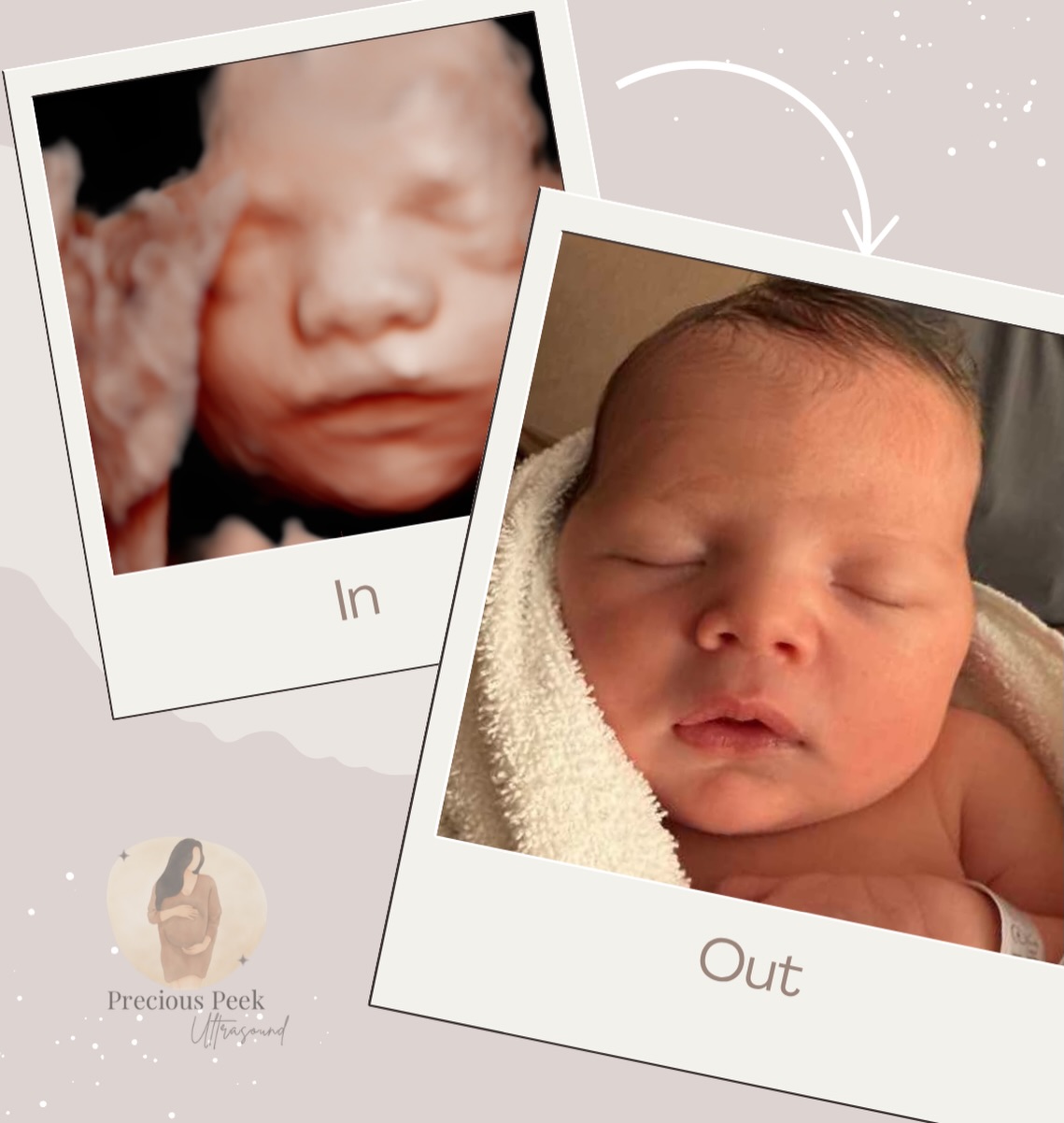 Cuteness overload!! 😭😍
#3dultrasound #4Dultrasound #treasurecoast #verobeach