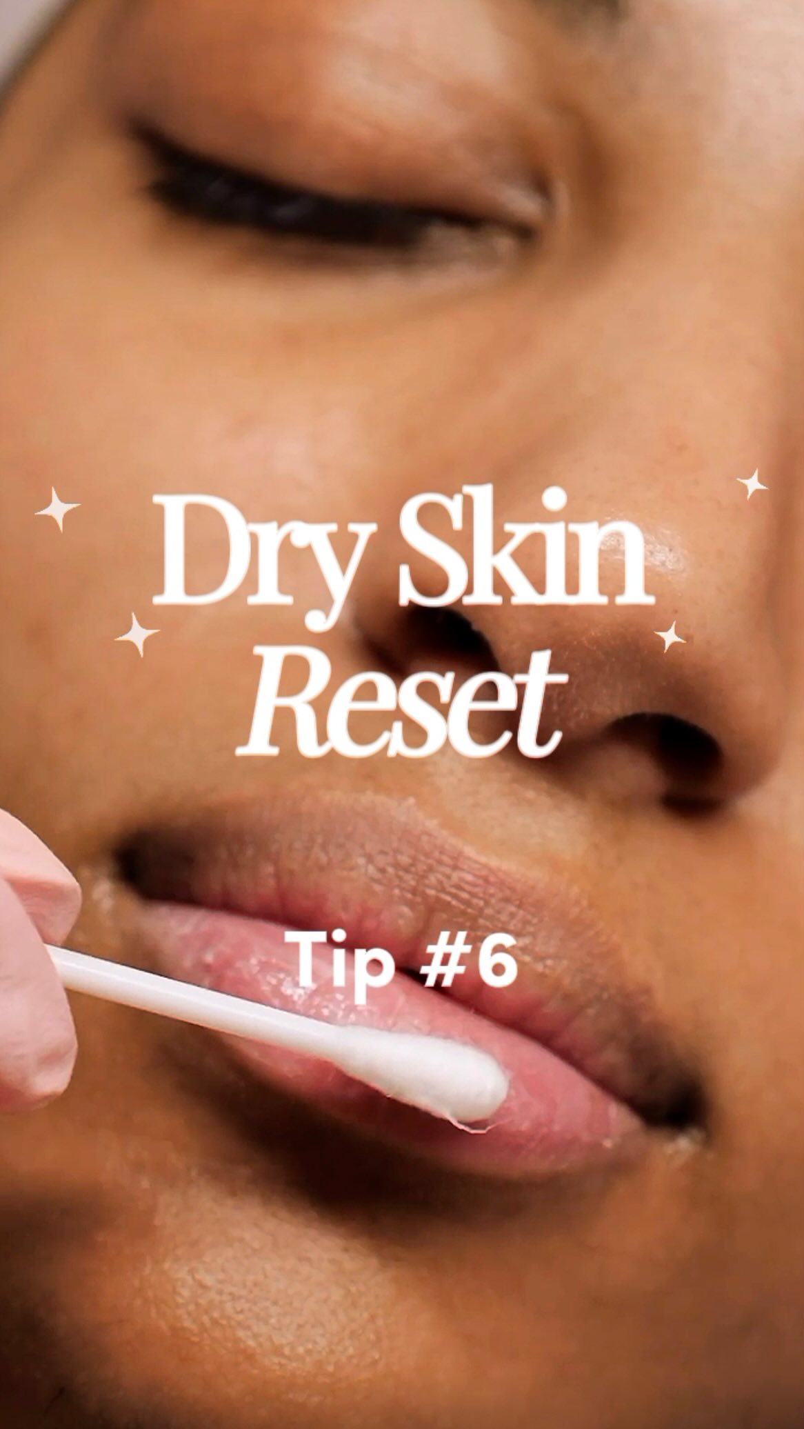 Want to know why your lips and hands are so dry? Read this. đ
Hands and lips are usually the first to feel dry⌠and the hardest to keep moisturized.
Hereâs why:
- Your lips have no oil glands, so they canât naturally keep themselves moisturized.
- Your hands (especially your palms) have fewer oil glands and are constantly exposed to washing, cold air, and friction throughout the day.
Hereâs how to give them the extra support they need:
1. After every hand wash, reapply your hand cream.
Water + soap strip your natural oils, and without replenishing them, dryness builds up quickly.
2. At night, switch to repair mode.
Use a thicker, more emollient hand cream and wear 100% cotton gloves while you sleep.
This helps lock in moisture and gives your skin time to recover.
3. Donât forget your lips.
Layer your hydrating face serum underneath your lip balm to keep them moisturized longer.
Dry, cracked hands and lips arenât just seasonal.
Theyâre a sign your barrier needs more support.
Follow along for the next step in your Dry Skin Reset.
#dryskintips #dryskinreset #northyorkskinclinic #torontowinter #medispa