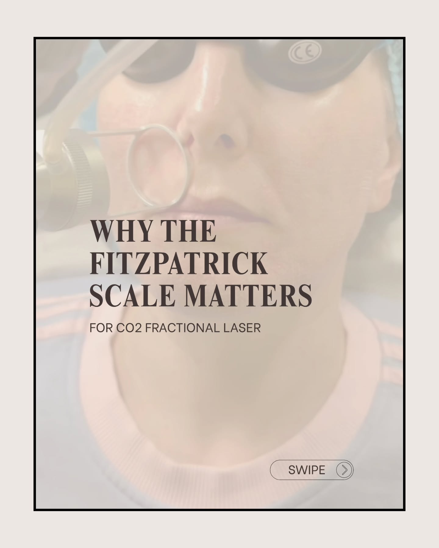 ✨🤍 WHY THE FITZPATRICK SCALE MATTERS 🤍✨
Understanding your skin type isn’t optional when it comes to advanced treatments—it’s essential.
The Fitzpatrick scale allows us to treat your skin safely, effectively, and with precision. From adjusting laser settings to planning your prep and aftercare, every step should be tailored to you.
This is how we minimise risks, protect your skin, and deliver results that are both visible and long-lasting.
If you’re considering CO2 fractional laser, a professional consultation is key.
#co2laser #laserresurfacing #skineducation #co2lasercheshire #co2laserwarrington