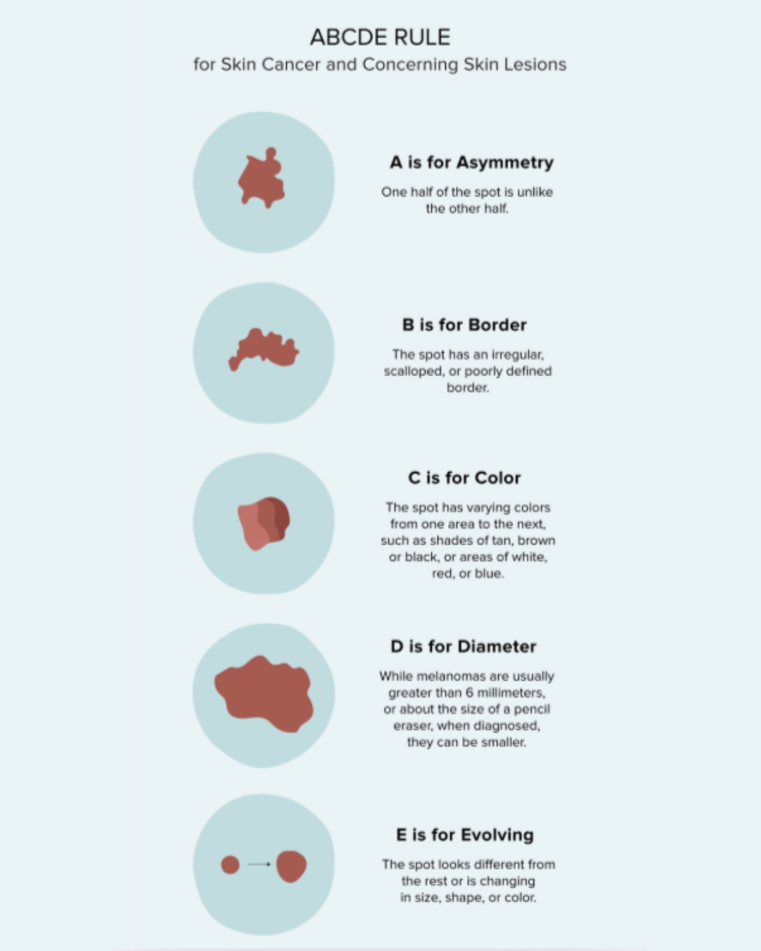 The ABCDE Rule is an easy way to spot warning signs of skin cancer early:
A — Asymmetry: One half doesn’t match the other
B — Border: Edges are irregular, ragged, or blurred
C — Color: Multiple colors or uneven shading
D — Diameter: Larger than a pencil eraser (about 6mm)
E — Evolving: Changes in size, shape, or color over time
If you notice any of these signs, don’t ignore them — early detection matters.
Schedule a skin check and make self-exams part of your routine.
📞 Call: 520-382-3330
➤ Visit: 2732 N. Alvernon Way Tucson, AZ 85712
➤ Visit: www.specialistsindermatology.com
#SpecialistsinDermatology #TucsonArizona #CheckYourSkin